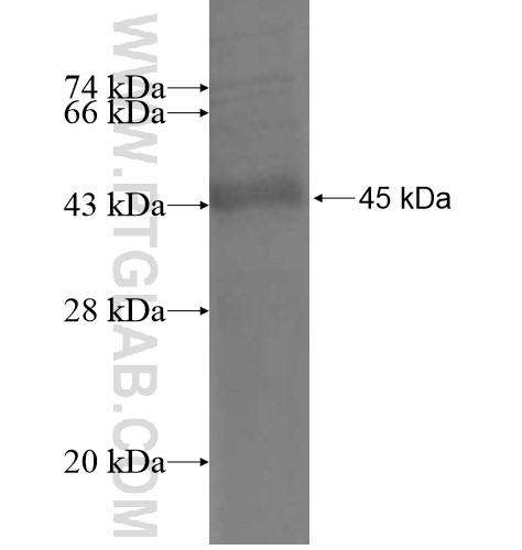 CD5 fusion protein Ag11097 SDS-PAGE
