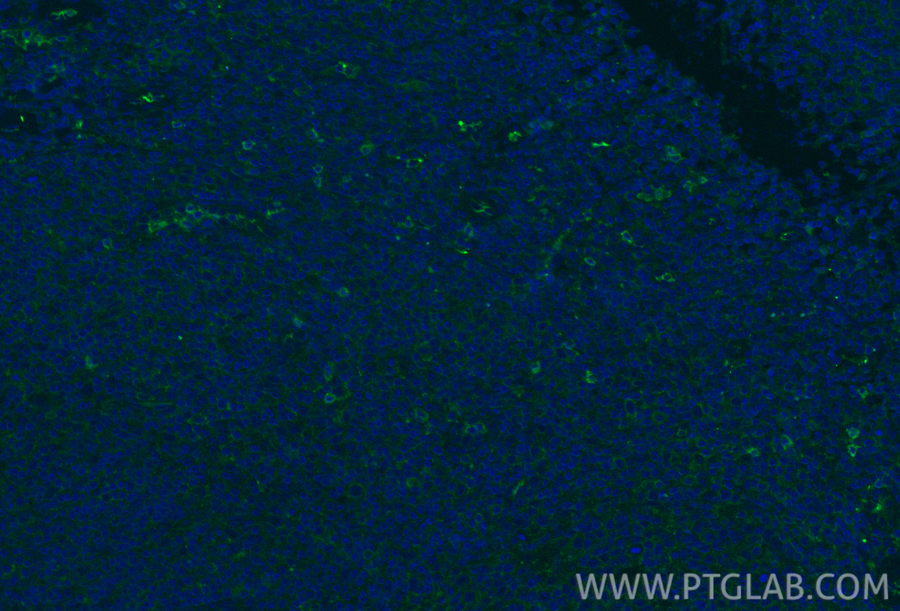 IF Staining of human tonsillitis using 21809-1-AP IF Staining of human tonsillitis using 21809-1-AP