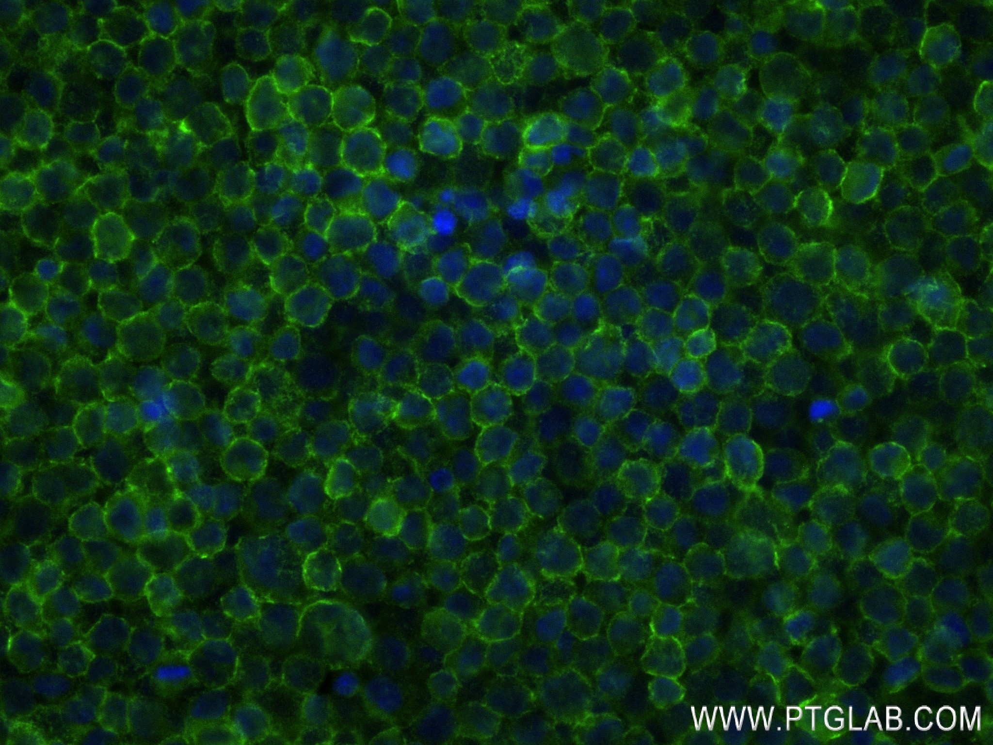 IF Staining of Daudi using 84837-1-RR