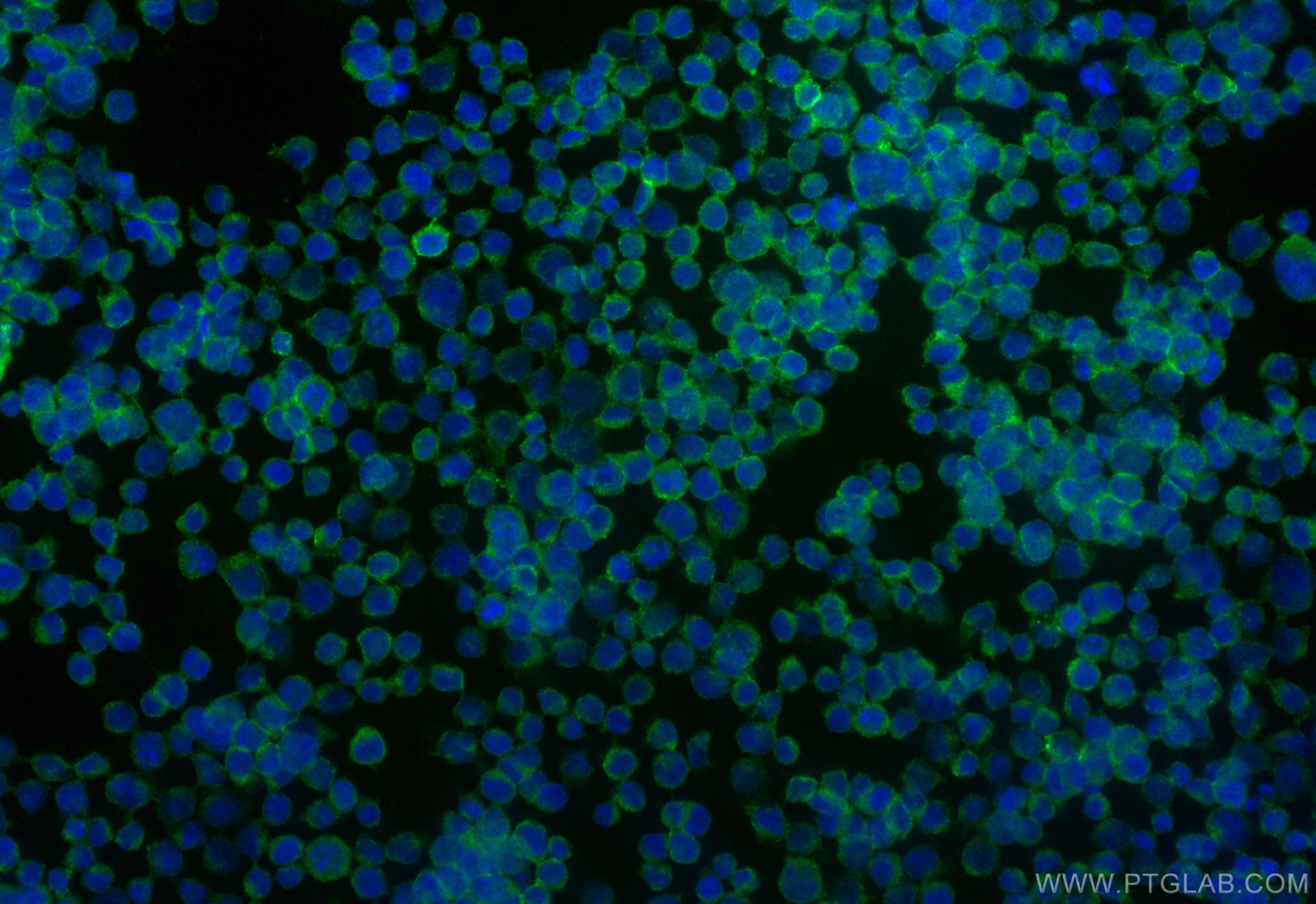IF Staining of Jurkat using 84837-1-RR