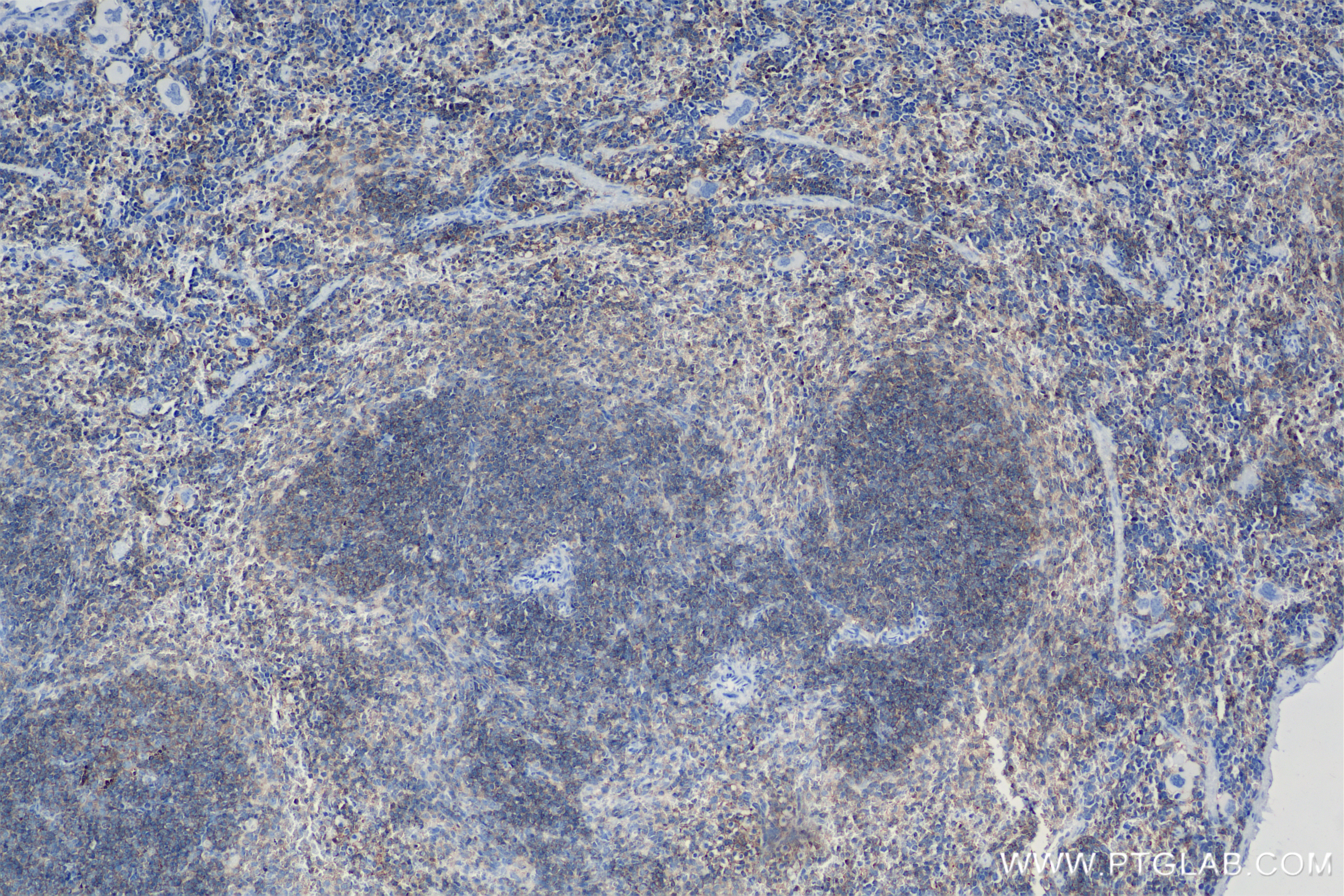 IHC staining of mouse spleen using 85838-3-RR
