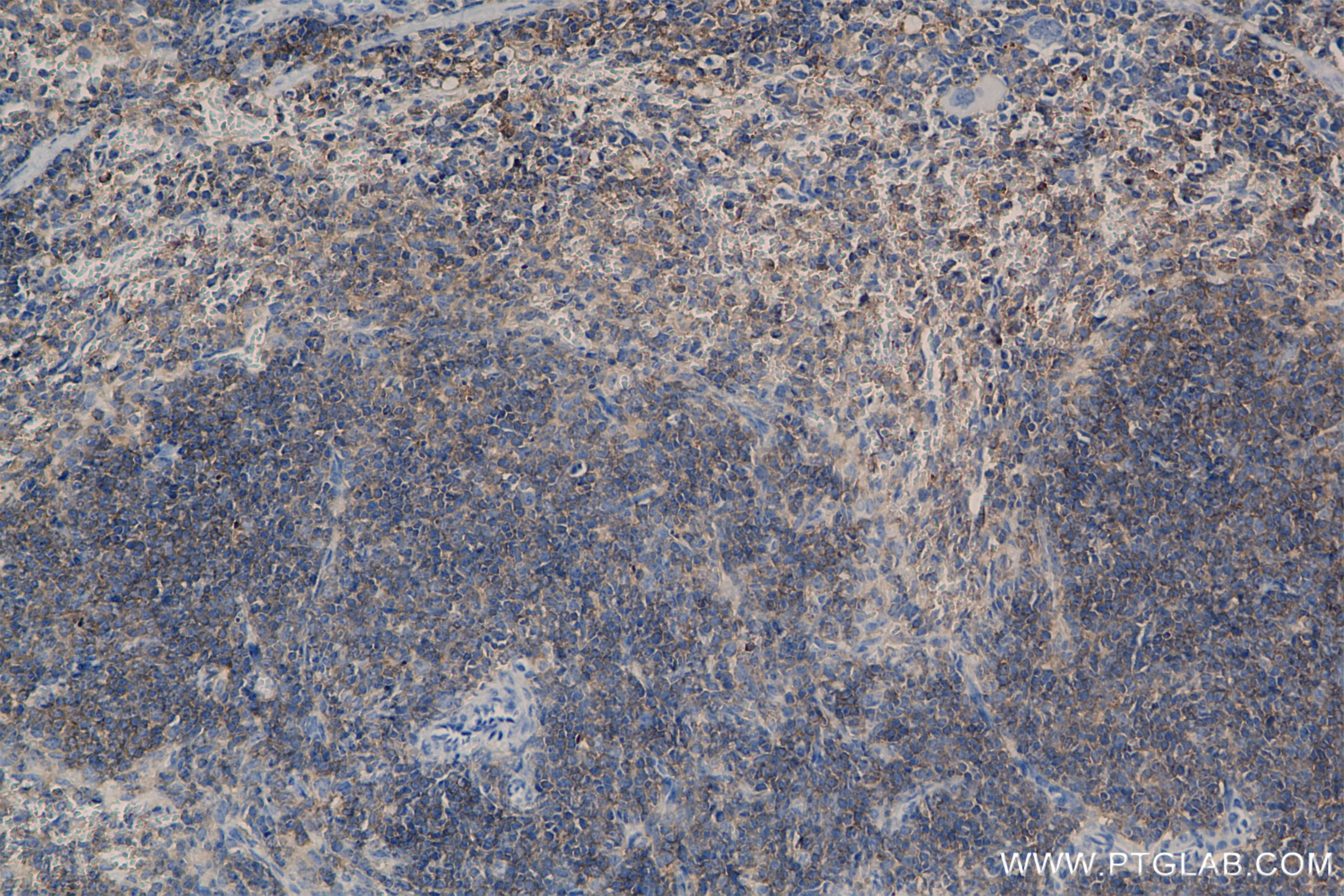 IHC staining of mouse spleen using 85838-3-RR