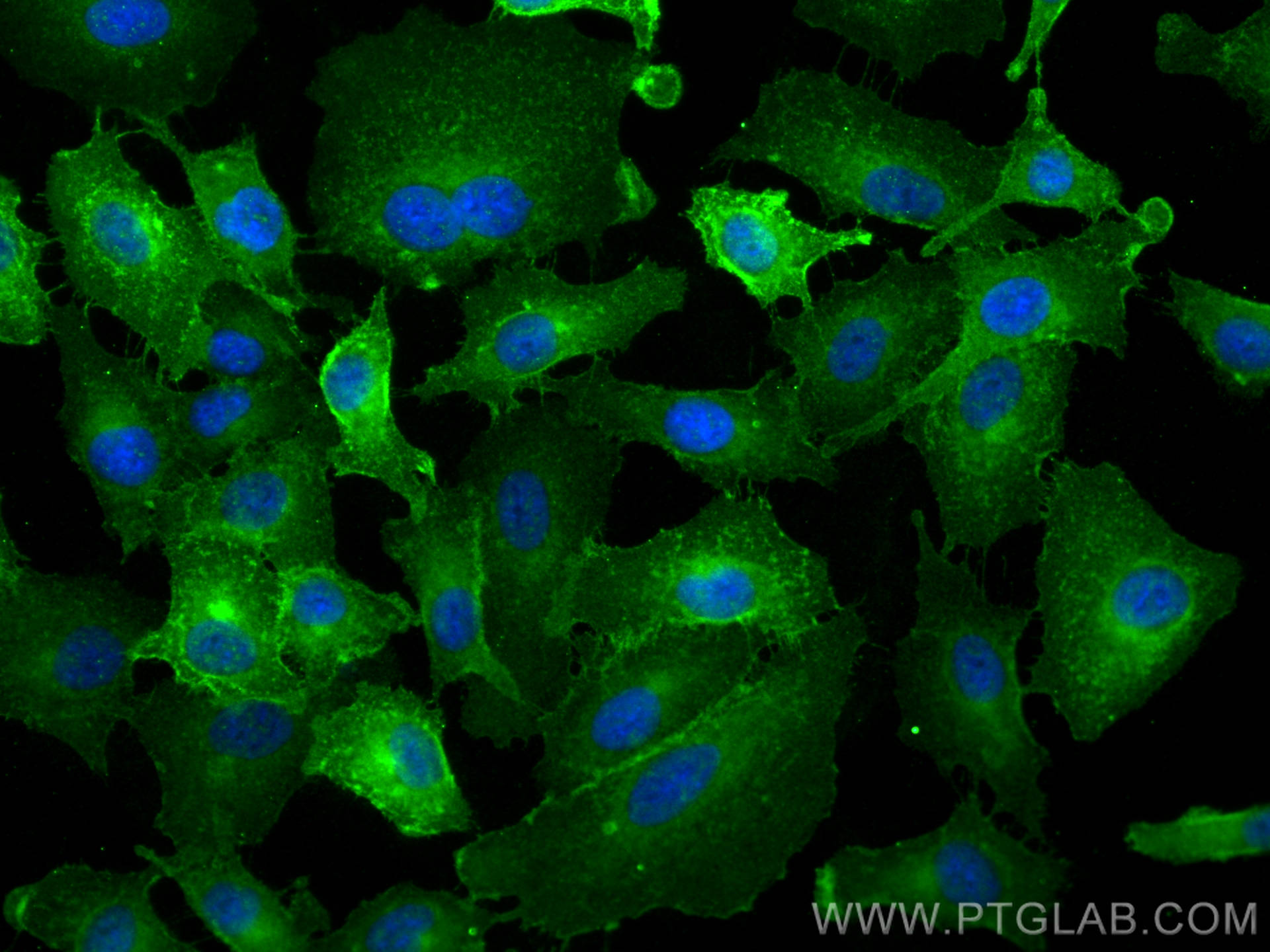 IF Staining of A549 using 26580-1-AP