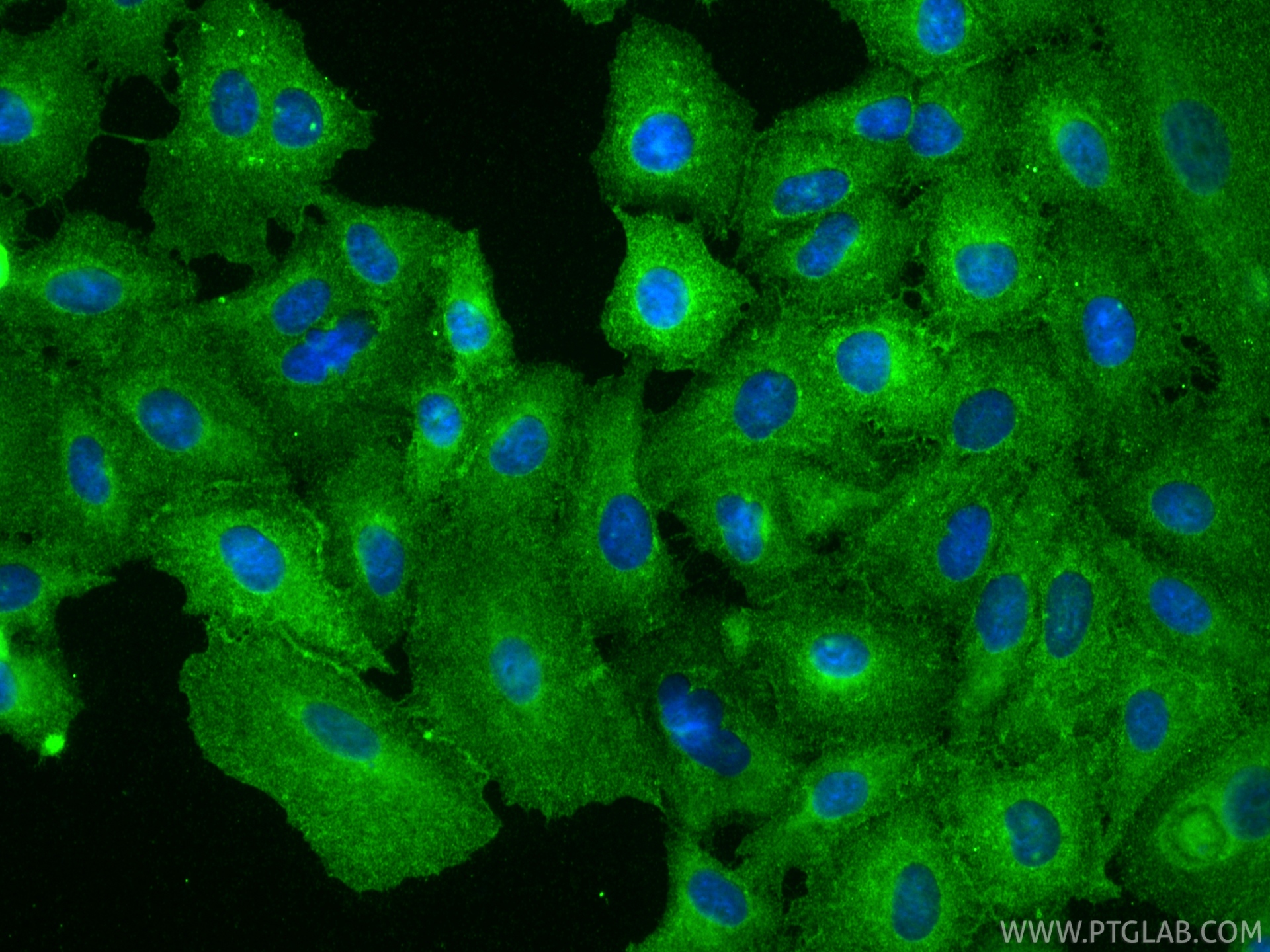 Immunofluorescent analysis of (-20°C Methanol) fixed A549 cells using CD55 antibody (26580-1-AP) at dilution of 1:400 and CoraLite®488-Conjugated Goat Anti-Rabbit IgG(H+L) (<a class='green' href='/productredirect?CatalogNo=SA00013-2' target='_blank'>SA00013-2</a>). IF Staining of A549 using 26580-1-AP
