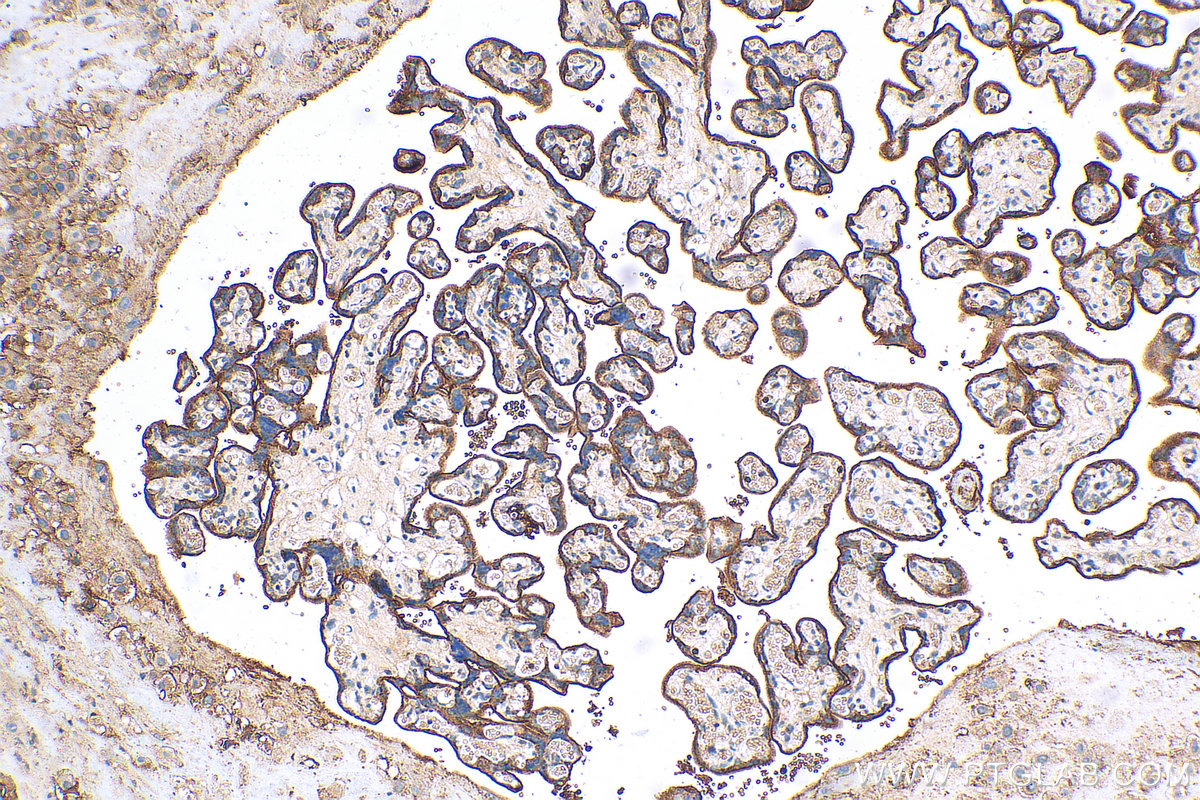 IHC staining of human placenta using 26580-1-AP