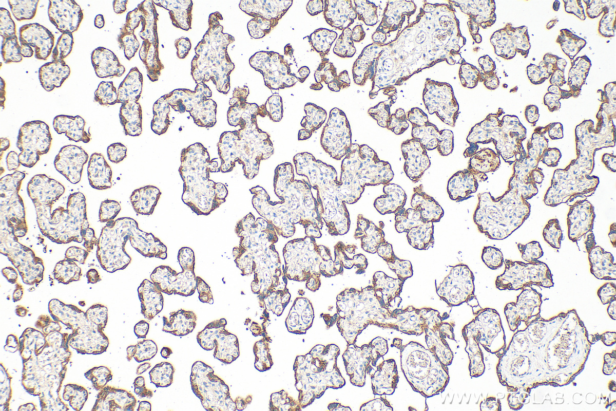 IHC staining of human placenta using 26580-1-AP