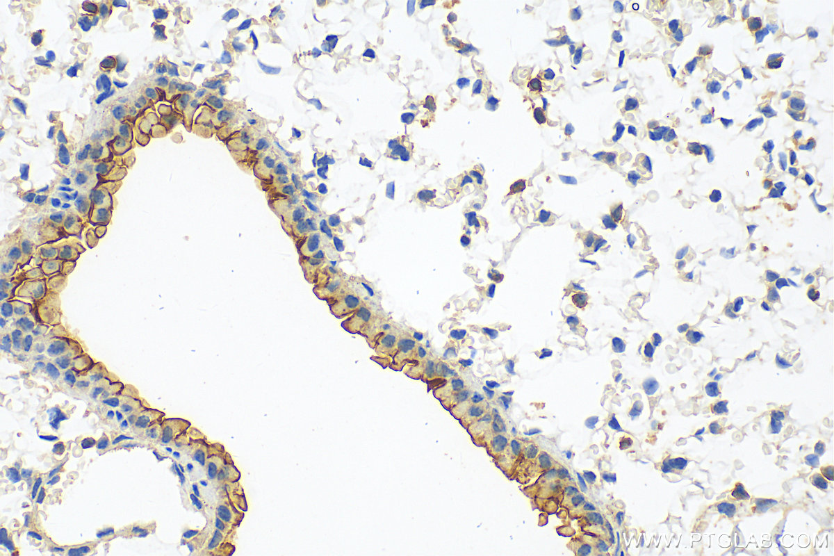 IHC staining of mouse lung using 32061-1-AP