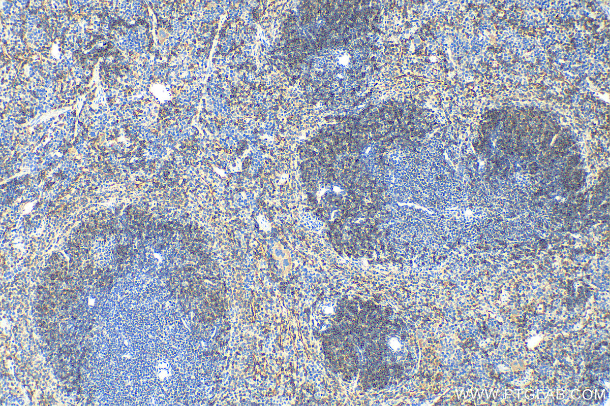 IHC staining of mouse spleen using 32061-1-AP