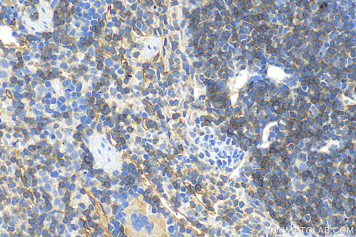 IHC staining of mouse spleen using 32061-1-AP