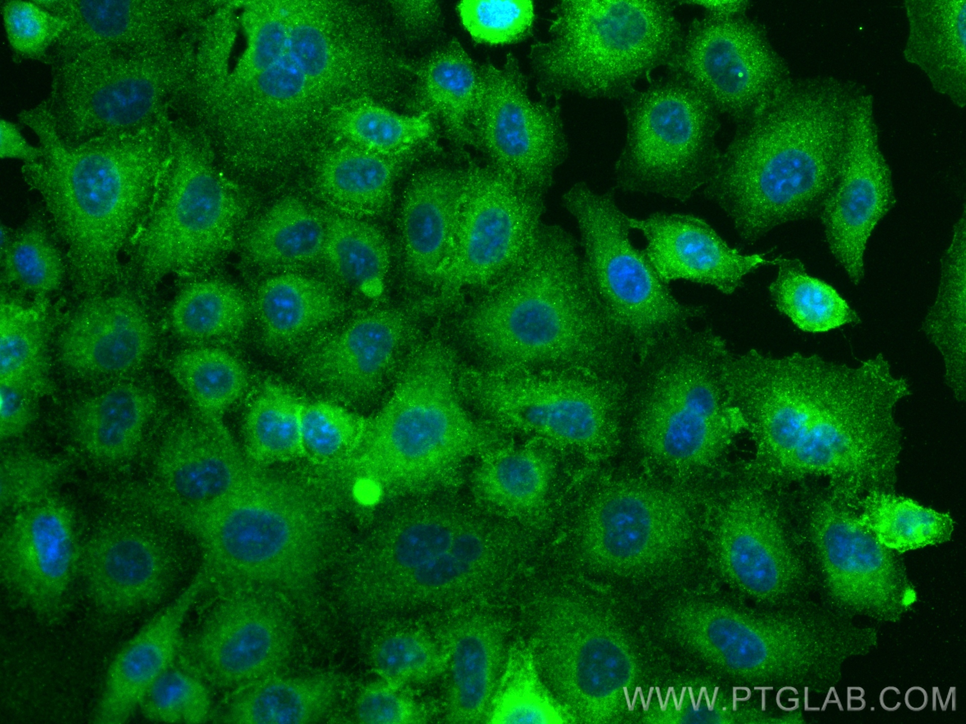 IF Staining of A549 using 82781-6-RR