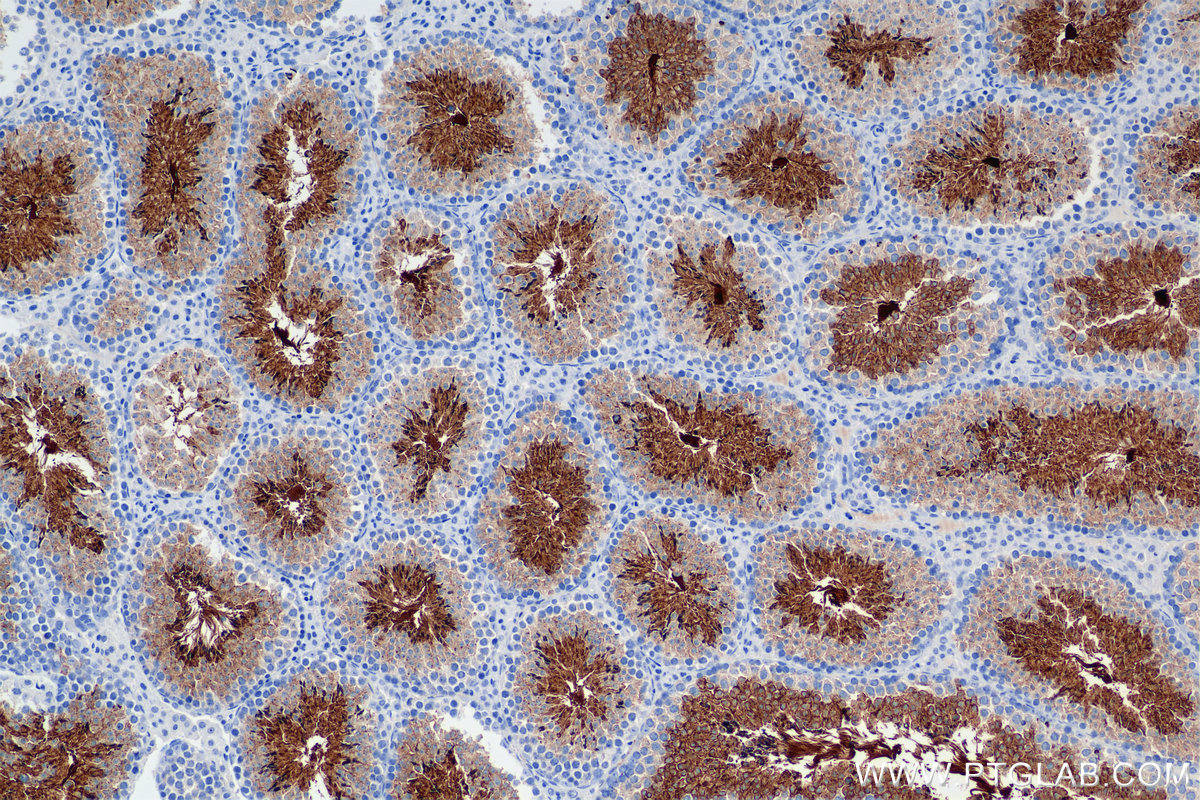 IHC staining of mouse testis using 84519-6-RR