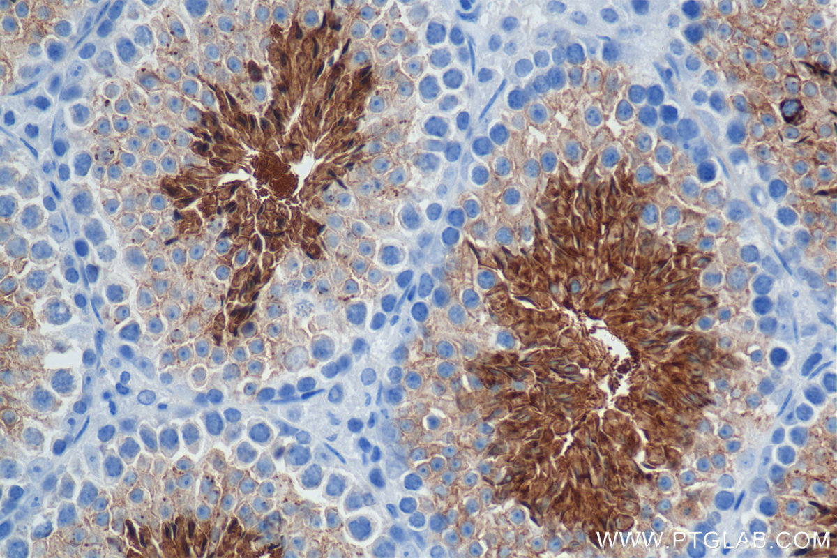 IHC staining of mouse testis using 84519-6-RR