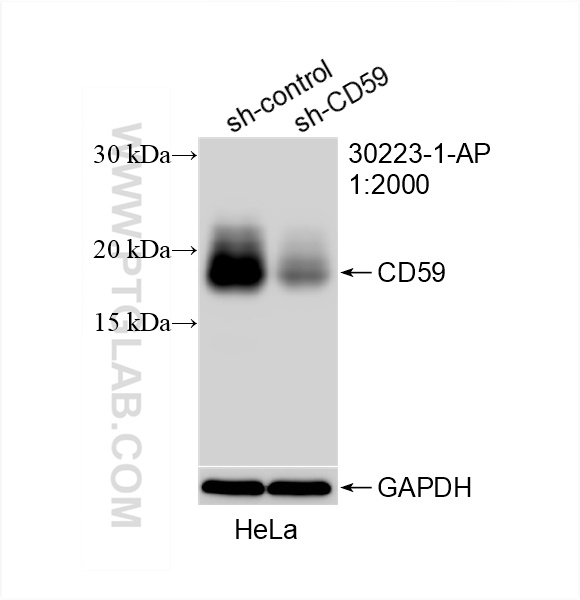 WB analysis of HeLa using 30223-1-AP