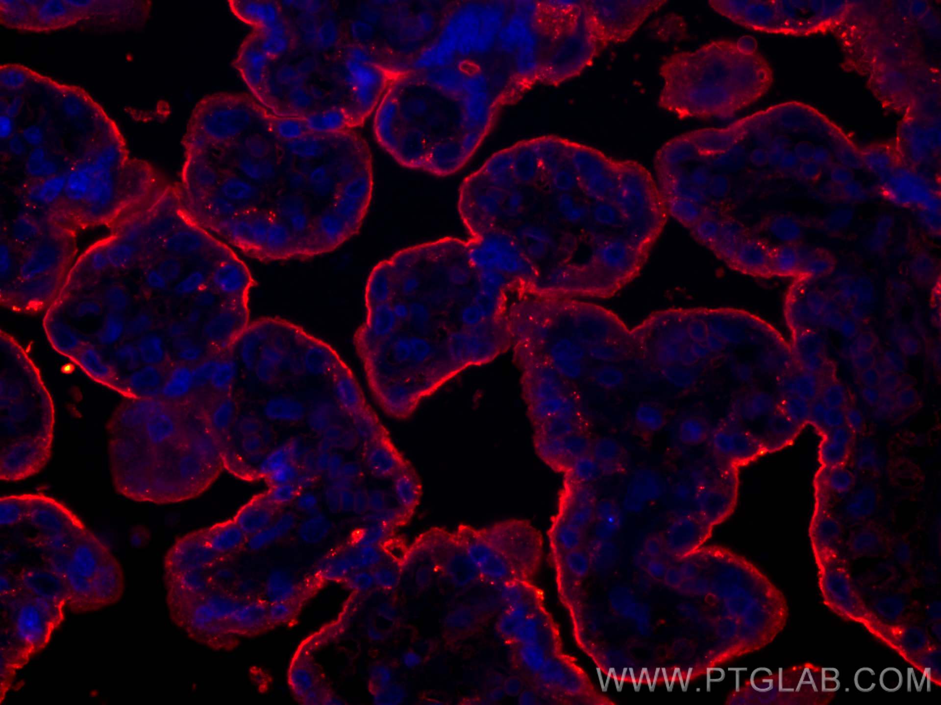 IF Staining of human placenta using 68222-1-Ig (same clone as 68222-1-PBS)