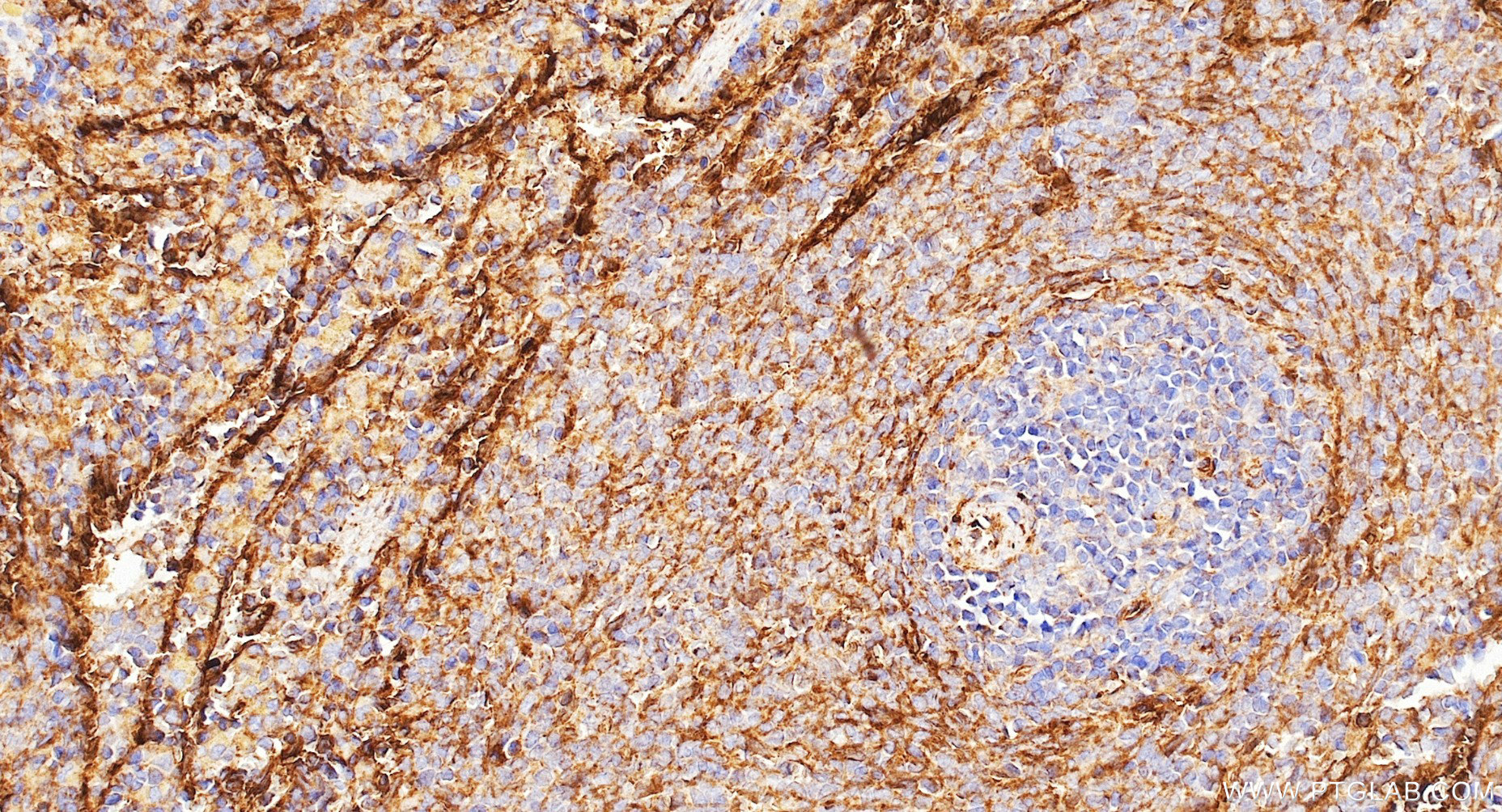 IHC staining of rat spleen using 87072-1-RR (same clone as 87072-1-PBS) IHC staining of rat spleen using 87072-1-RR (same clone as 87072-1-PBS)