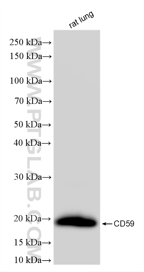 WB analysis of rat lung using 87072-1-RR (same clone as 87072-1-PBS) WB analysis of rat lung using 87072-1-RR (same clone as 87072-1-PBS)