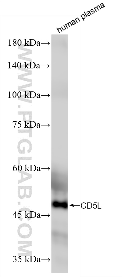 WB analysis of human plasma using 86638-1-RR WB analysis of human plasma using 86638-1-RR