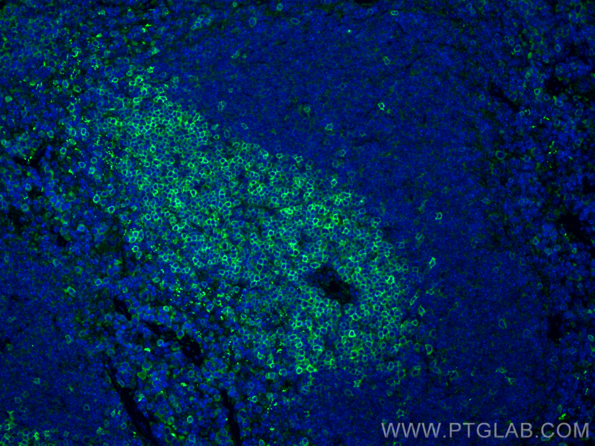 IF Staining of mouse spleen using 31998-1-AP