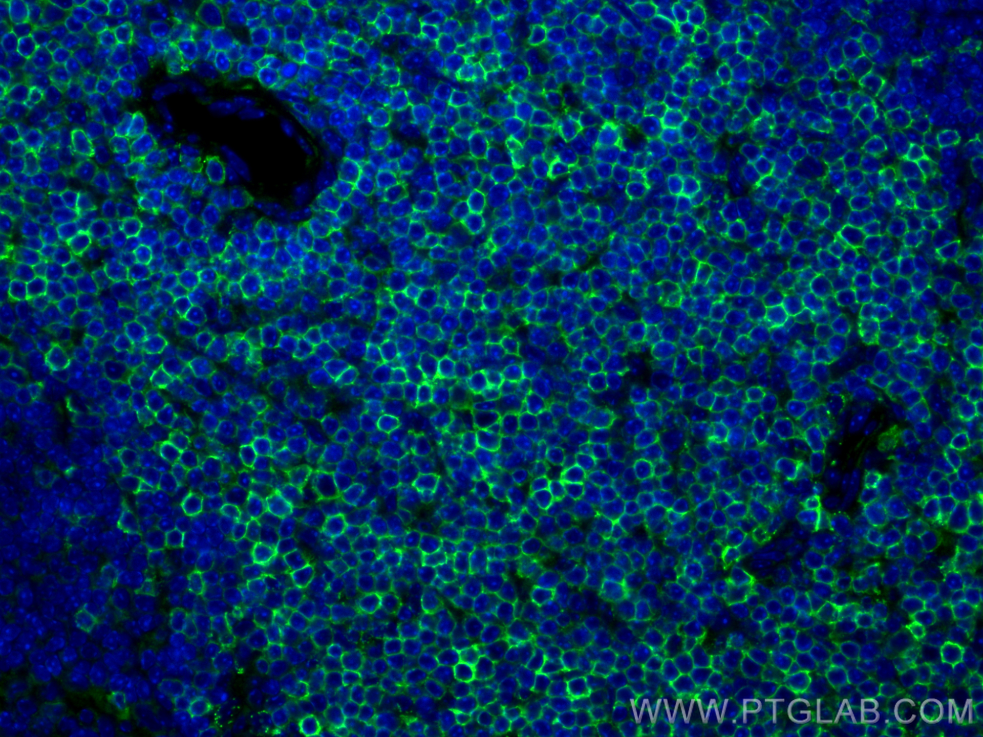 IF Staining of mouse spleen using 31998-1-AP