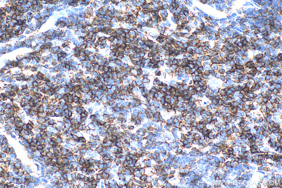 IHC staining of mouse thymus using 31998-1-AP