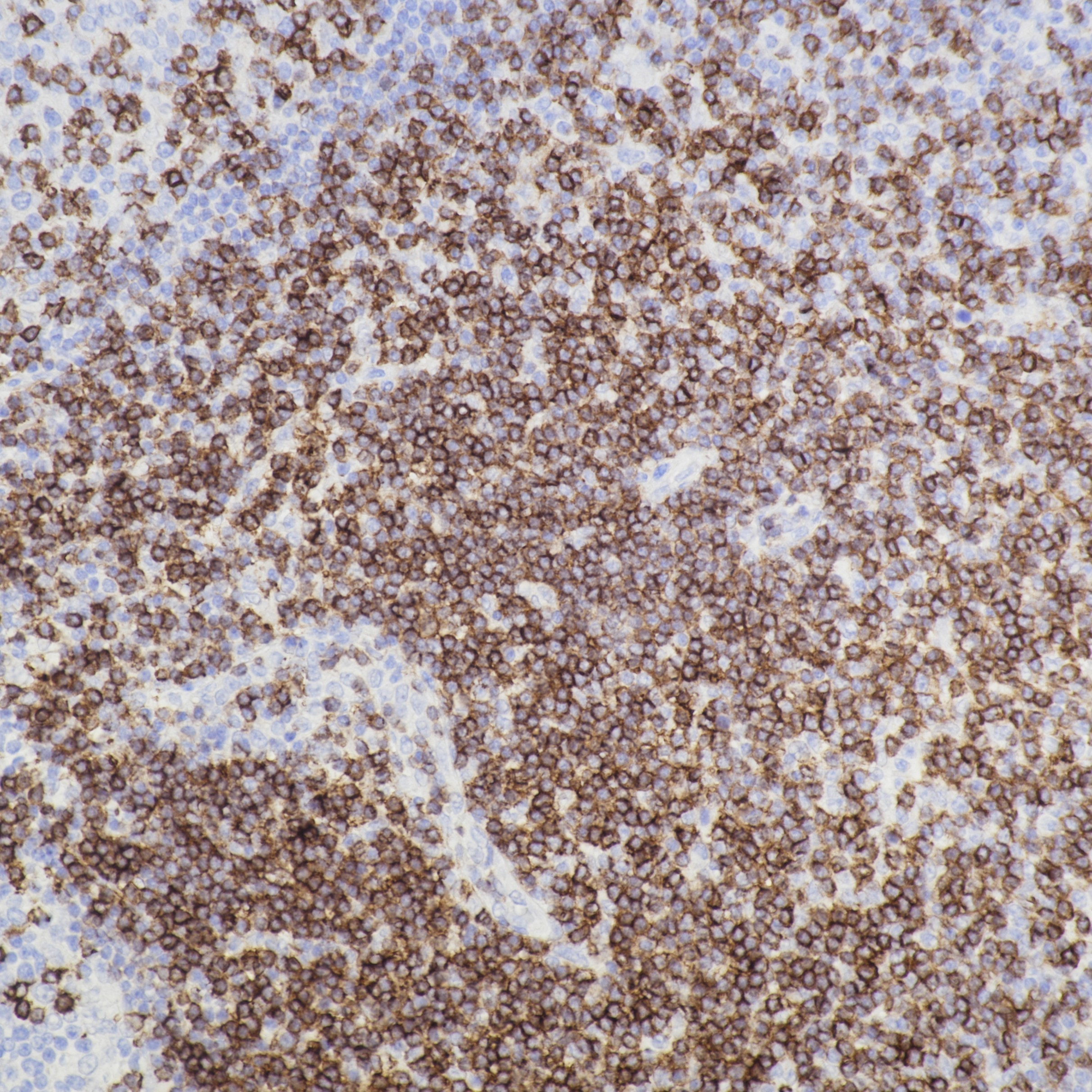 IHC staining of human tonsil using 84508-5-RR