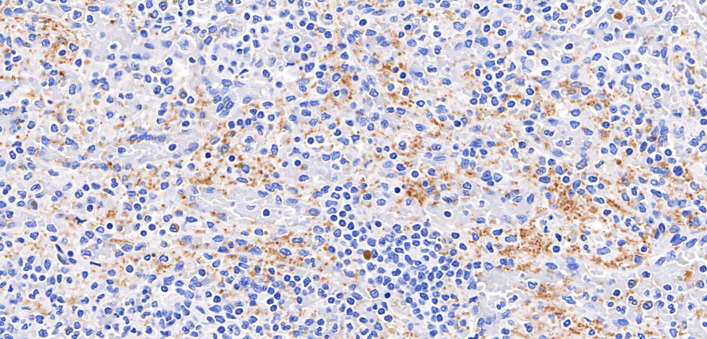 IHC staining of human spleen using 98864-1-RR (same clone as 98864-1-PBS) IHC staining of human spleen using 98864-1-RR (same clone as 98864-1-PBS)