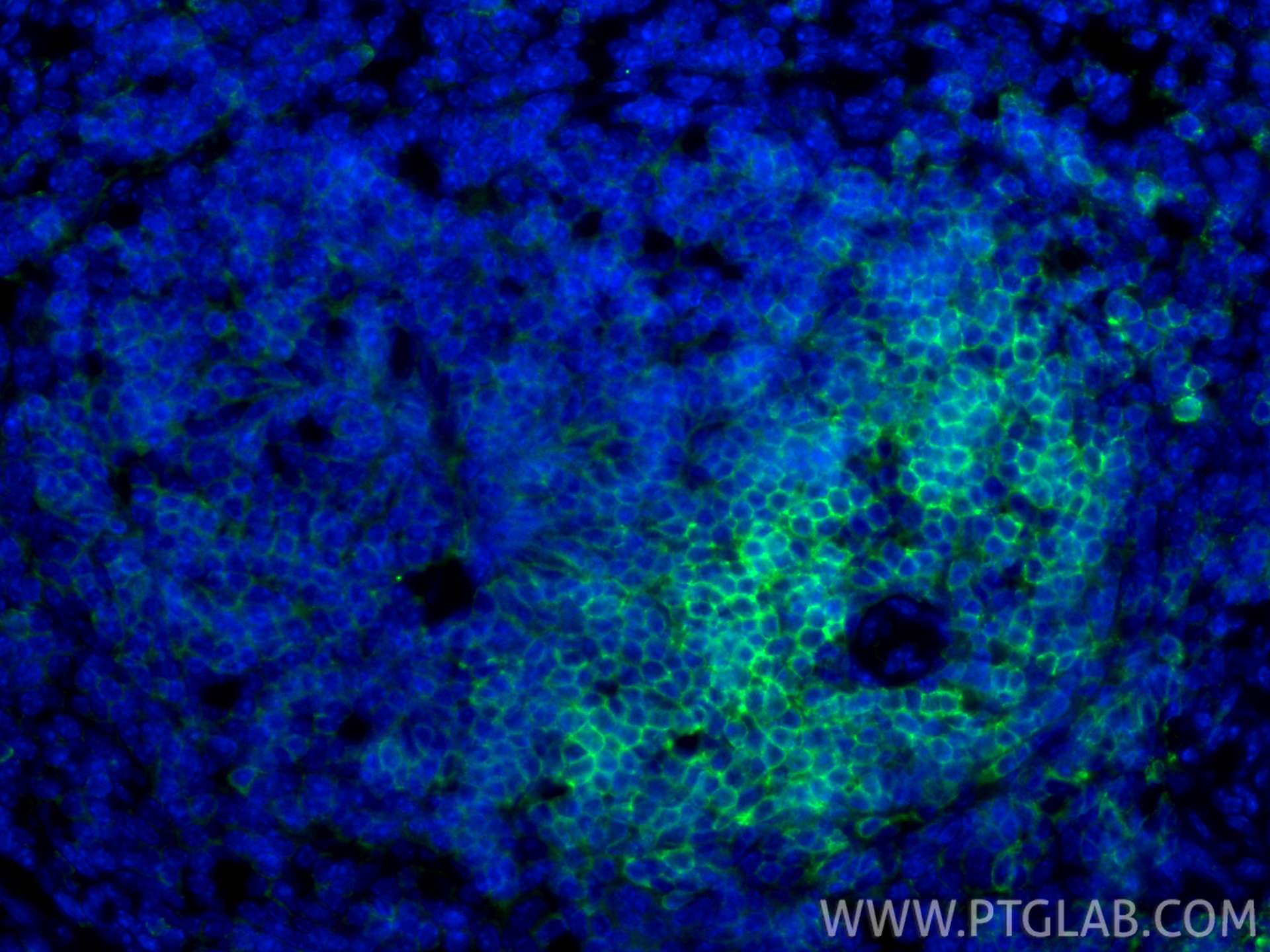 IF Staining of mouse spleen using 33173-1-AP