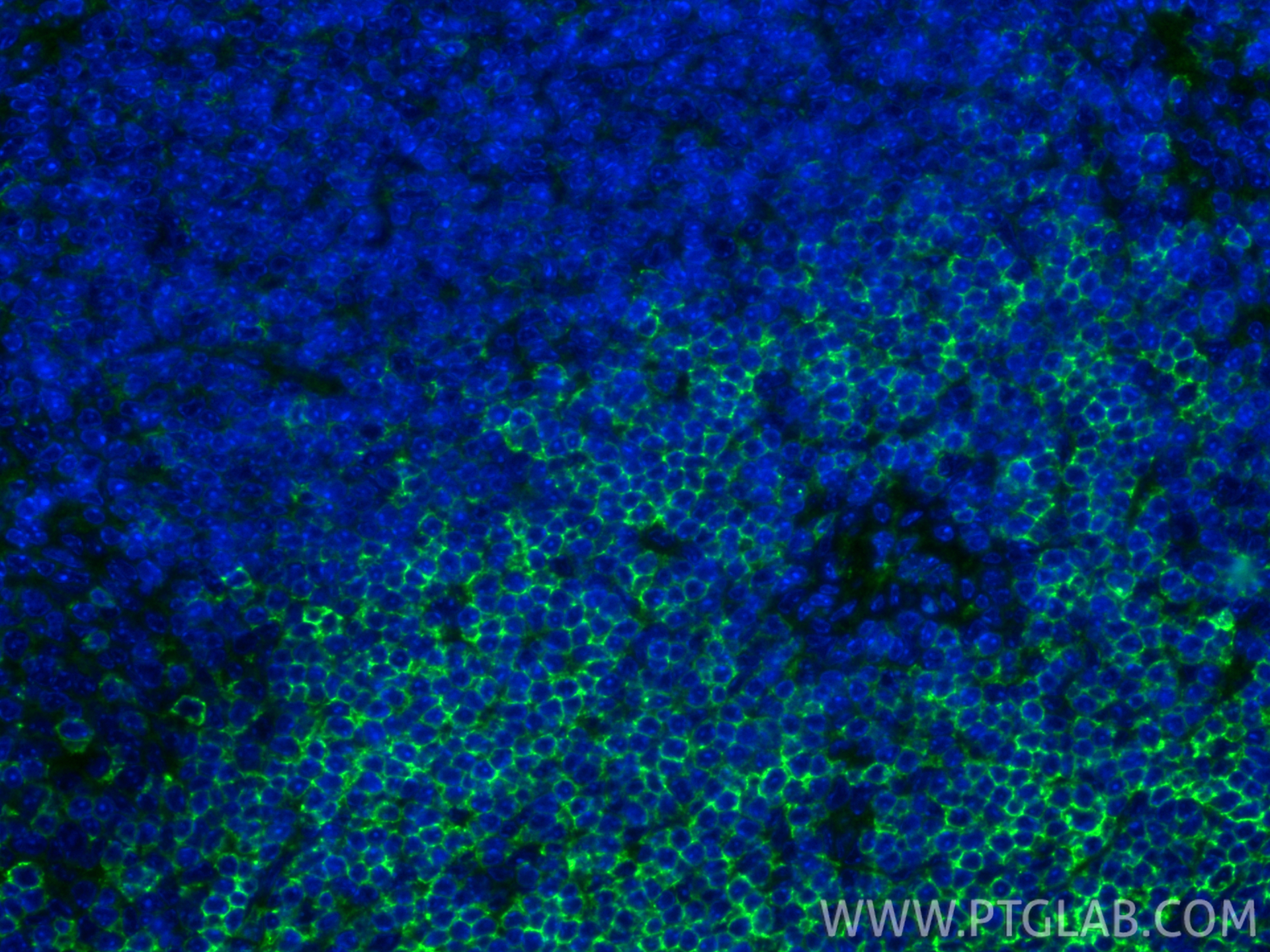 IF Staining of mouse spleen using 33173-1-AP