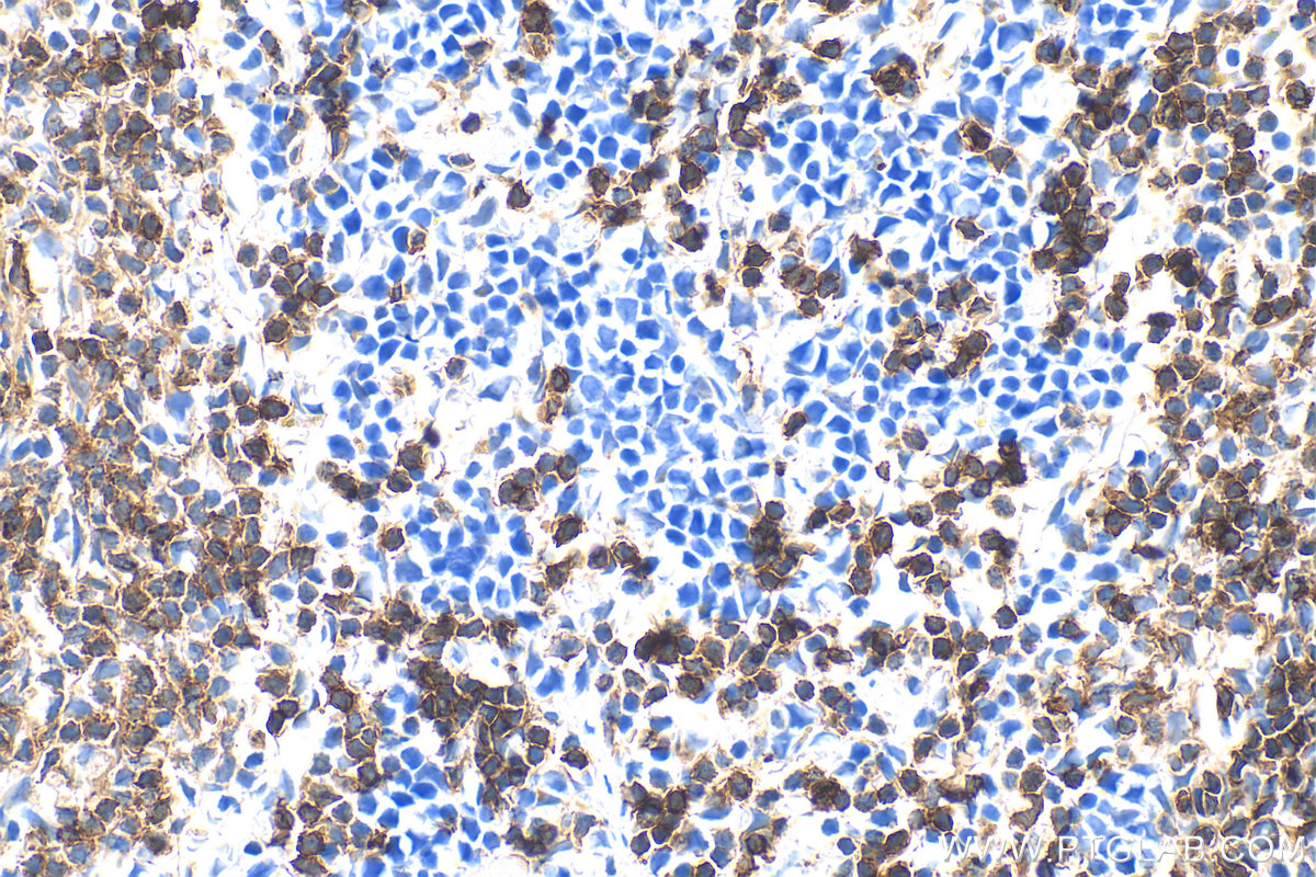 IHC staining of mouse spleen using 33173-1-AP