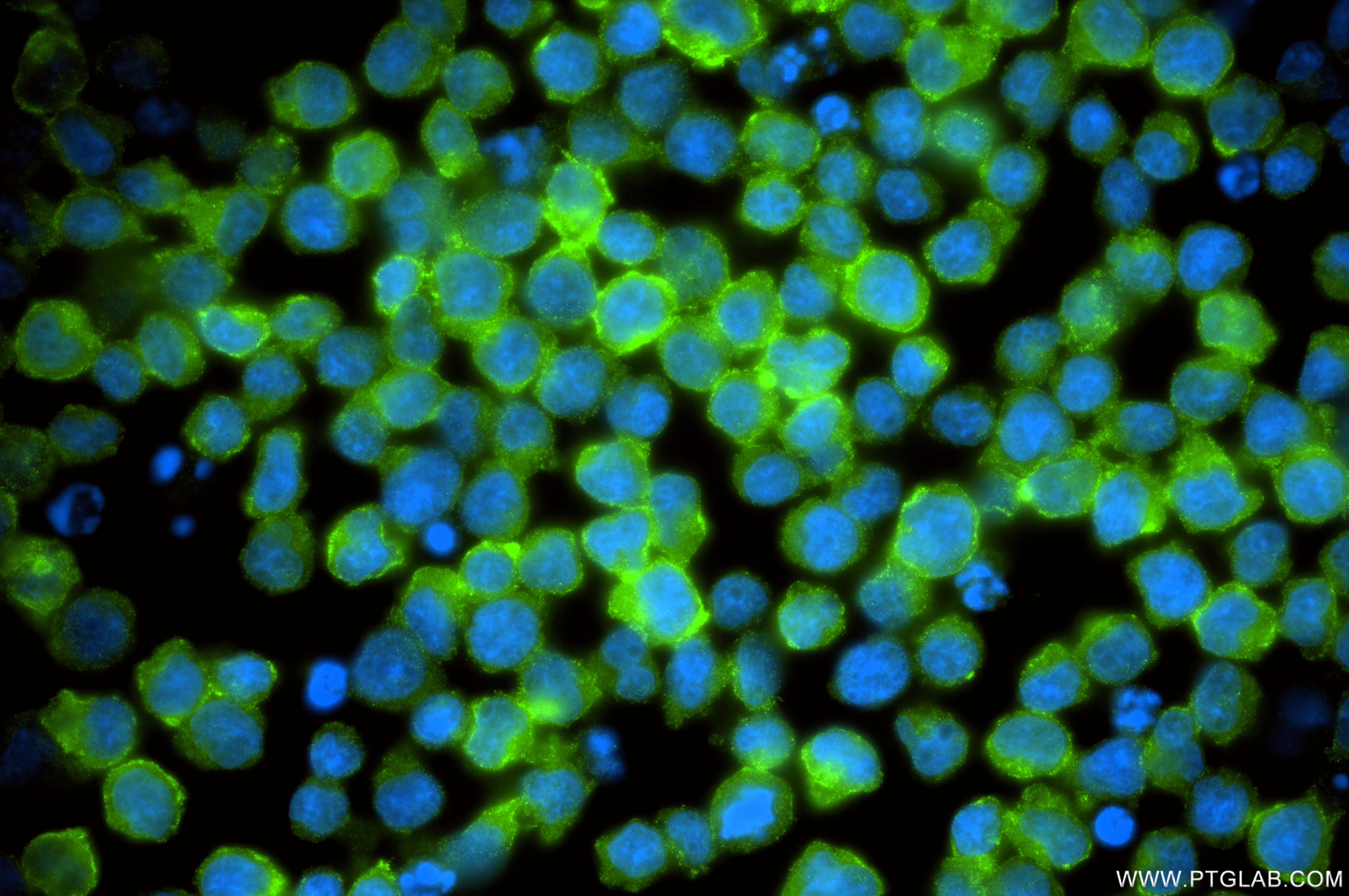 IF Staining of Jurkat using 85111-6-RR
