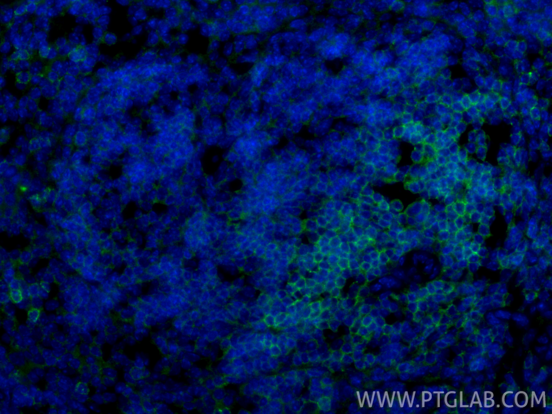 IF Staining of mouse spleen using 85903-1-RR IF Staining of mouse spleen using 85903-1-RR