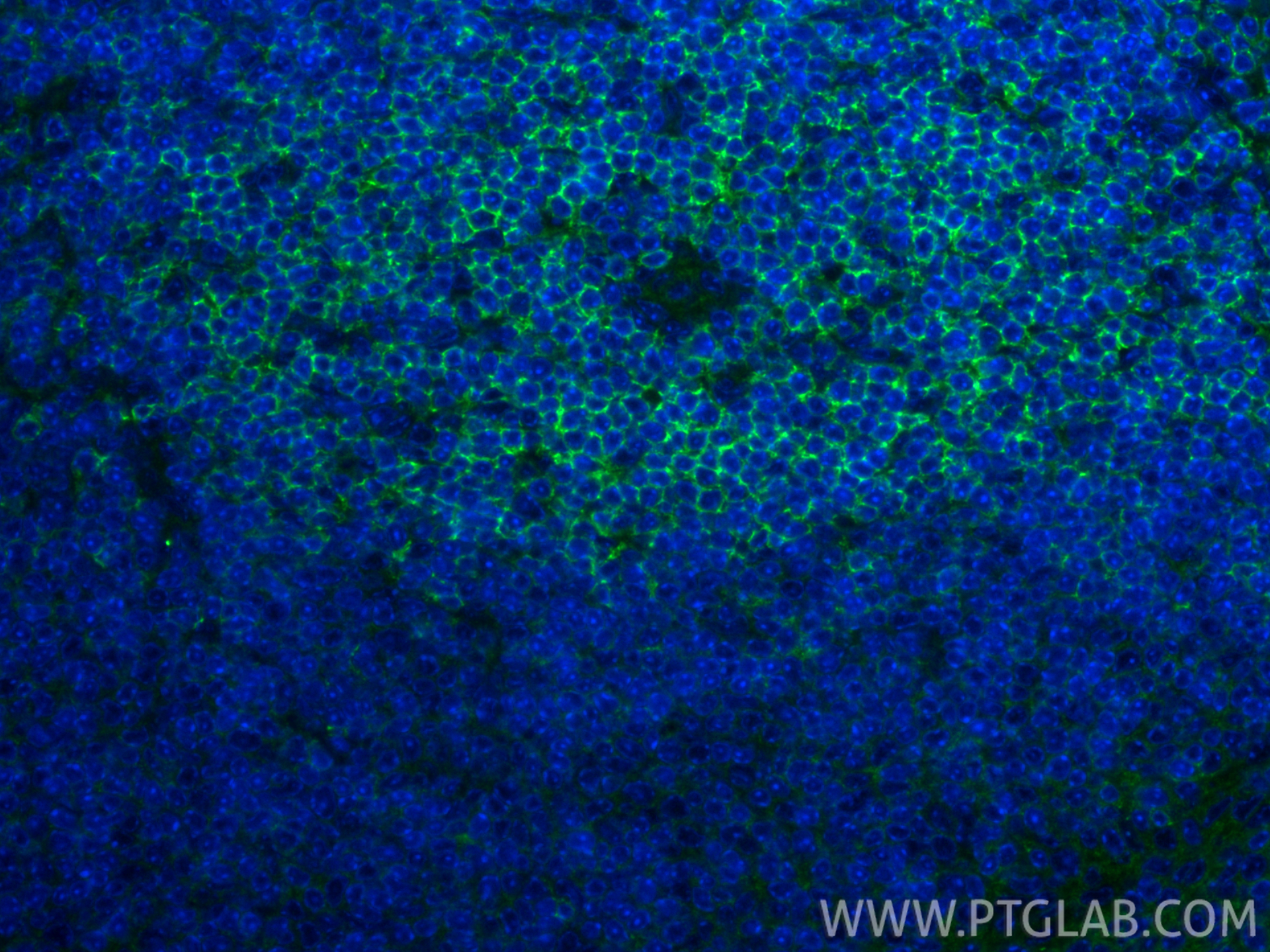 IF Staining of mouse spleen using 85903-1-RR IF Staining of mouse spleen using 85903-1-RR