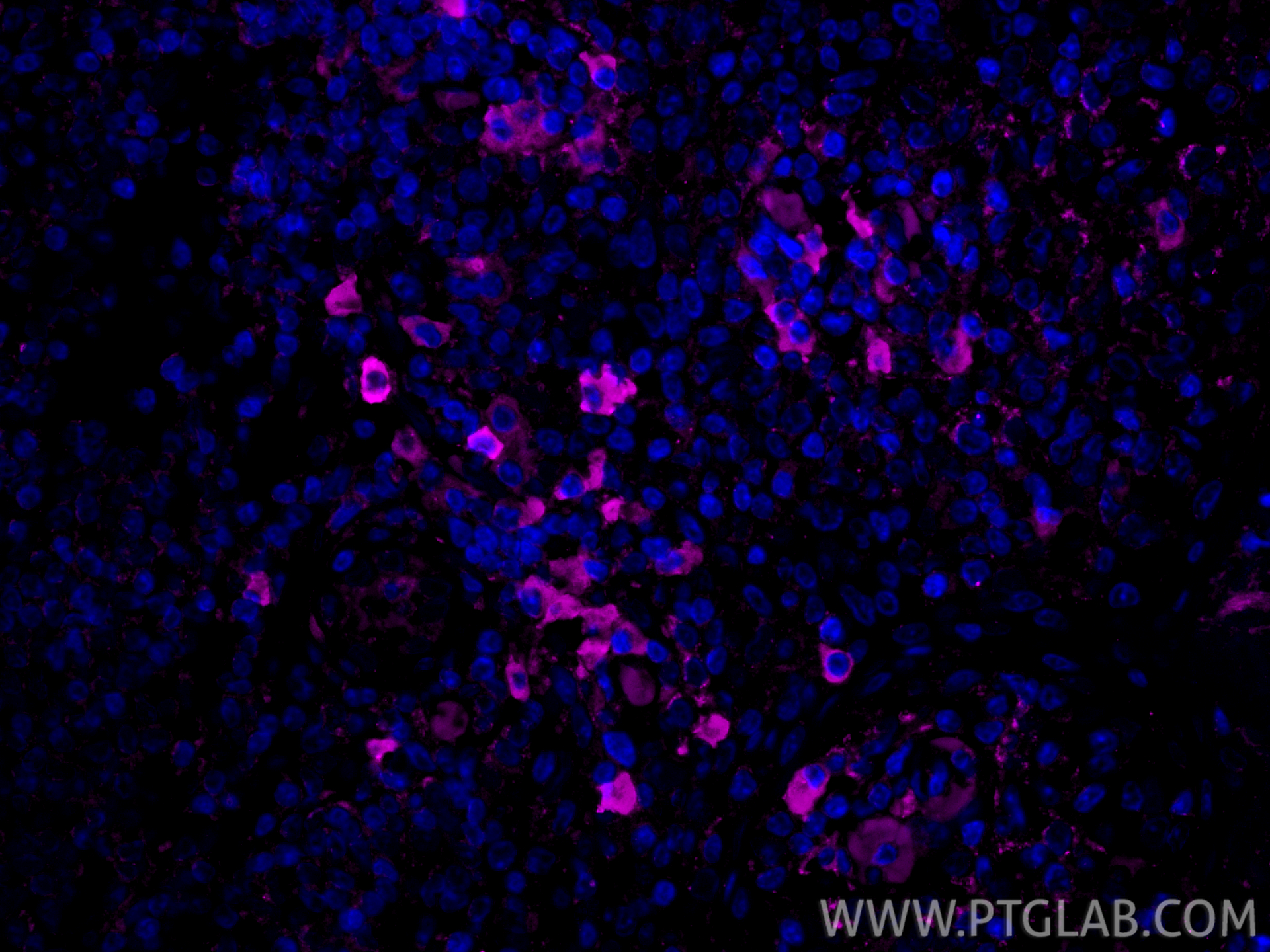 IF Staining of human tonsillitis using CL647-26477
