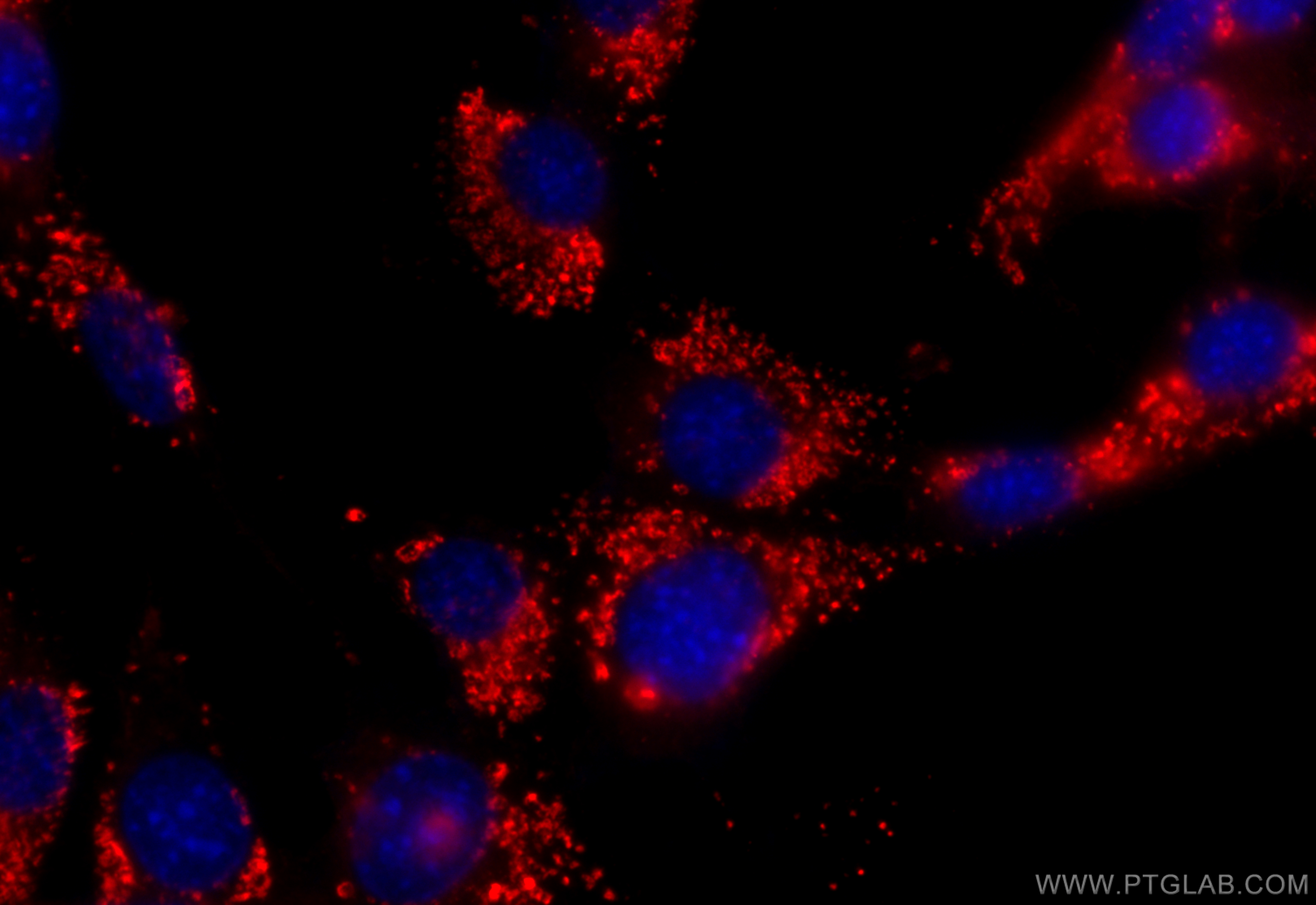 IF Staining of NIH/3T3 using 32151-1-AP
