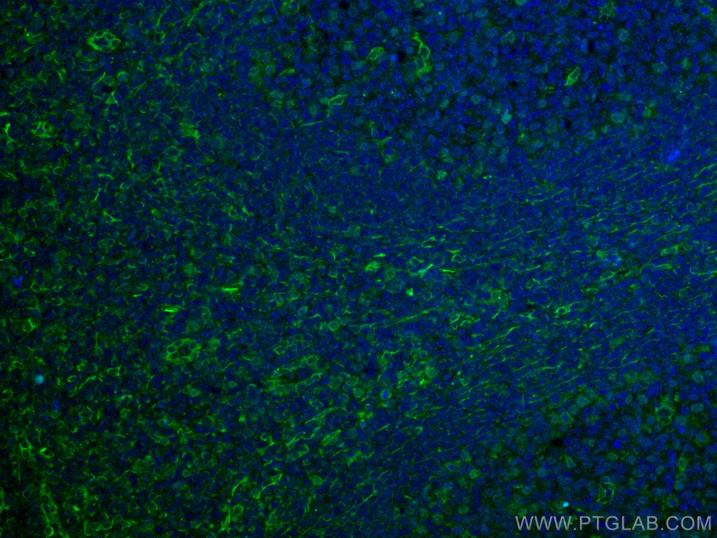 IF Staining of human tonsillitis using 67605-1-Ig (same clone as 67605-1-PBS)