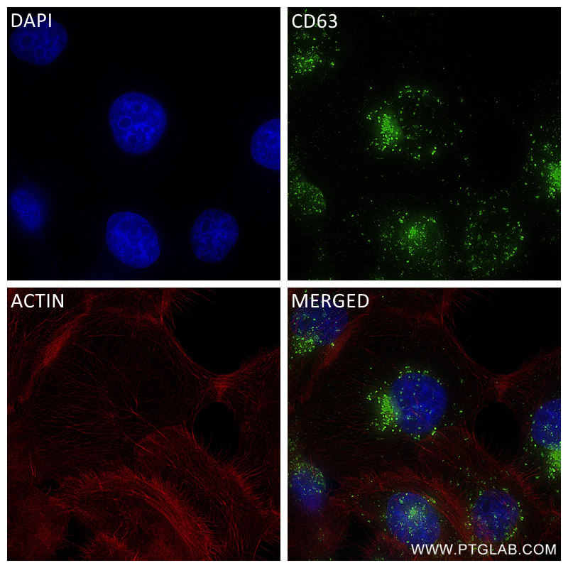 IF Staining of A431 using 84507-4-RR