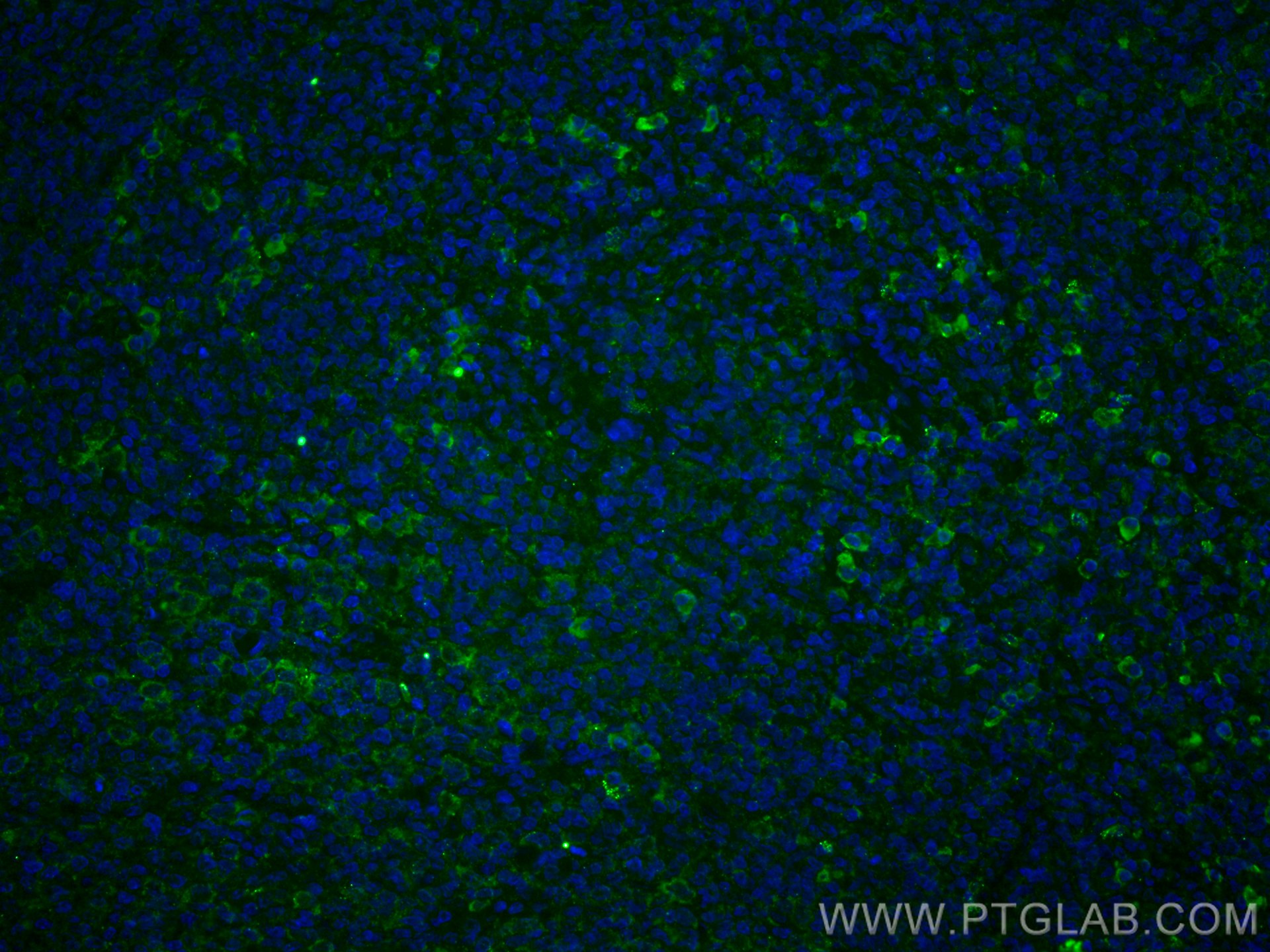 IF Staining of human tonsillitis using CL488-67605