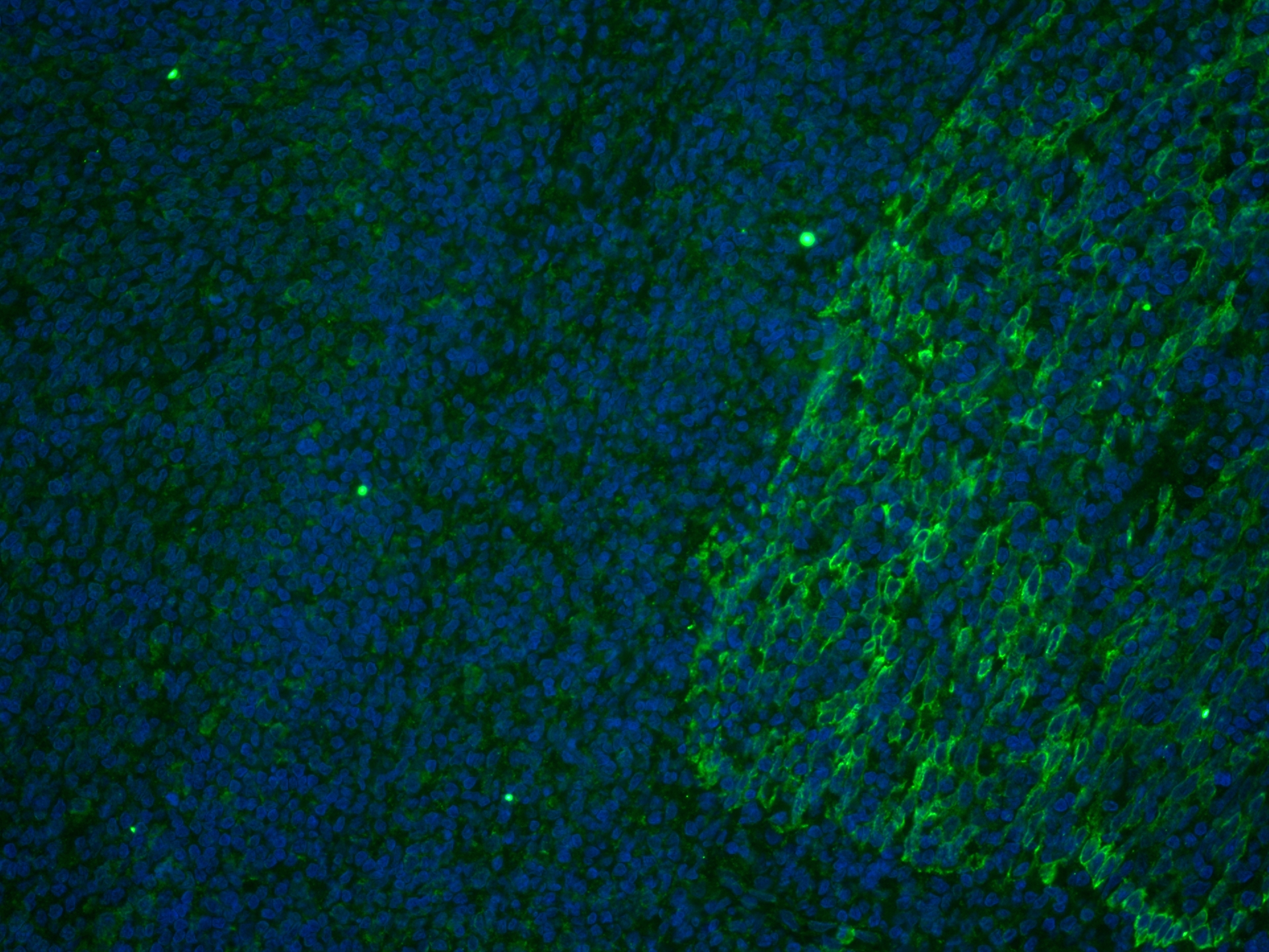 IF Staining of human tonsillitis using CL488-67605