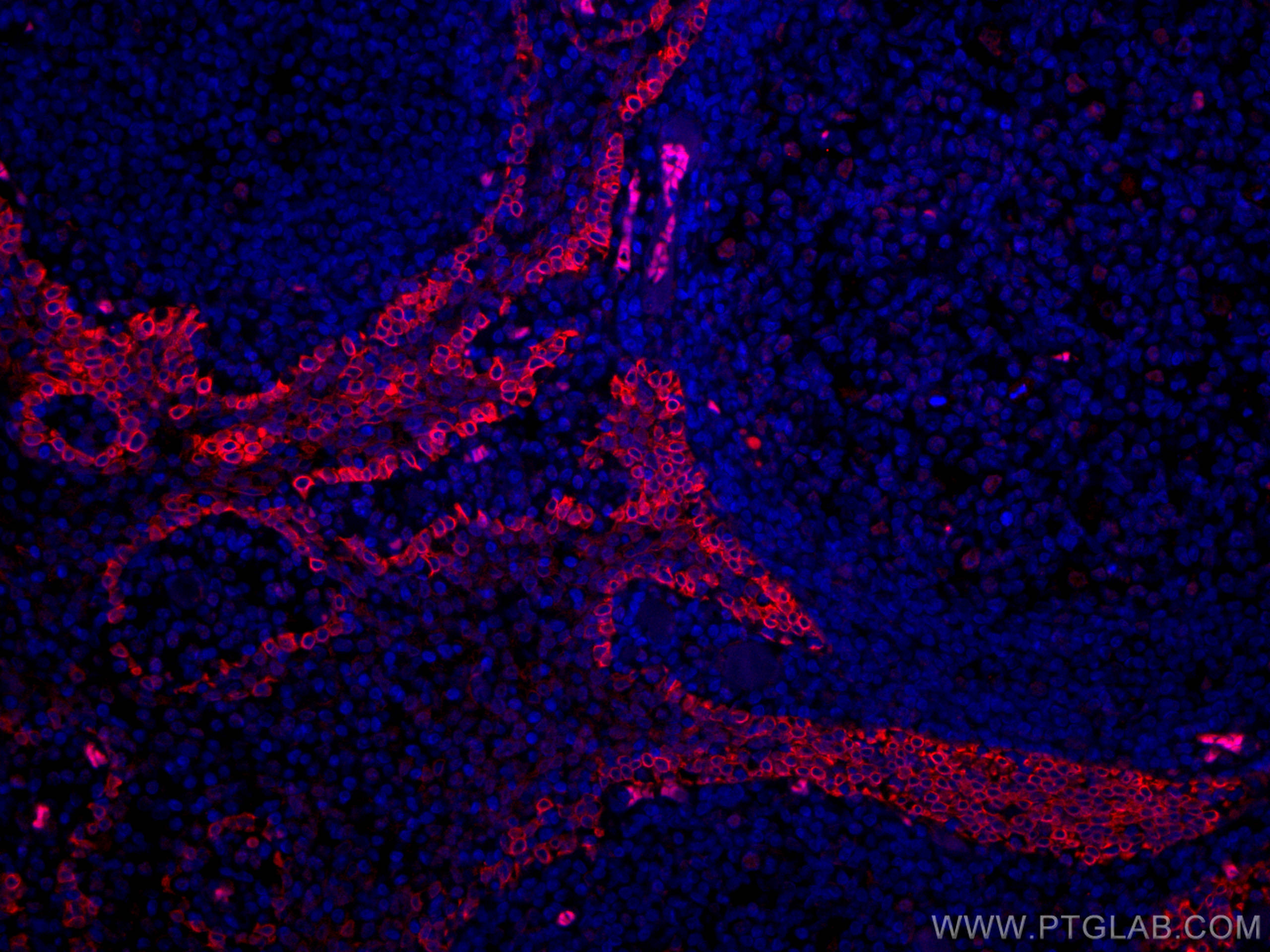 IF Staining of human tonsillitis using CL594-67605