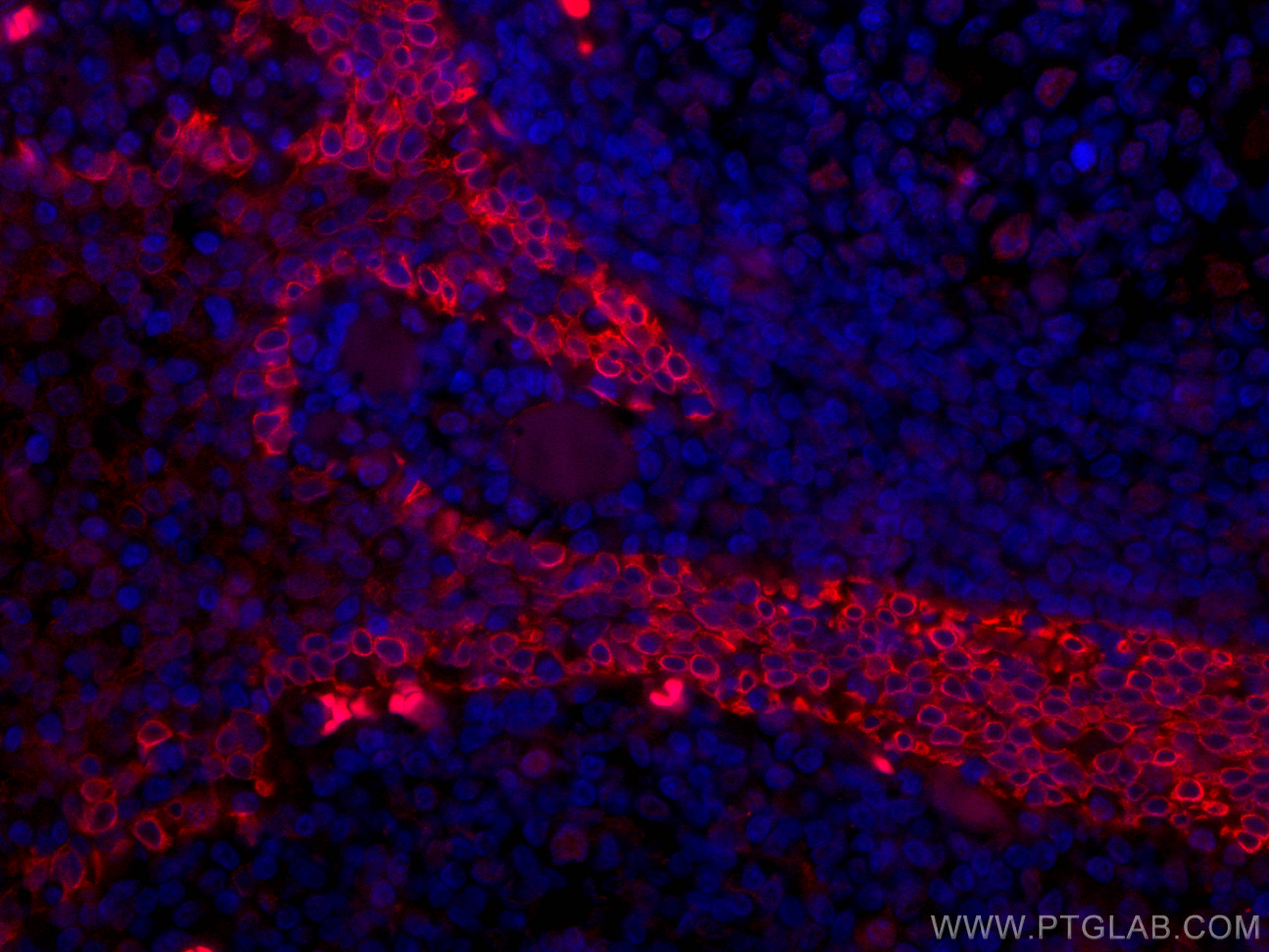IF Staining of human tonsillitis using CL594-67605