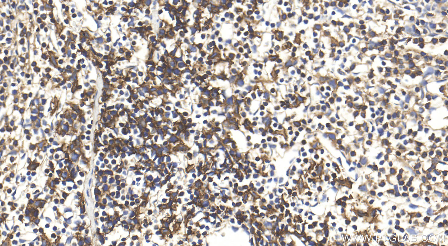 IHC staining of mouse spleen using 32060-1-AP