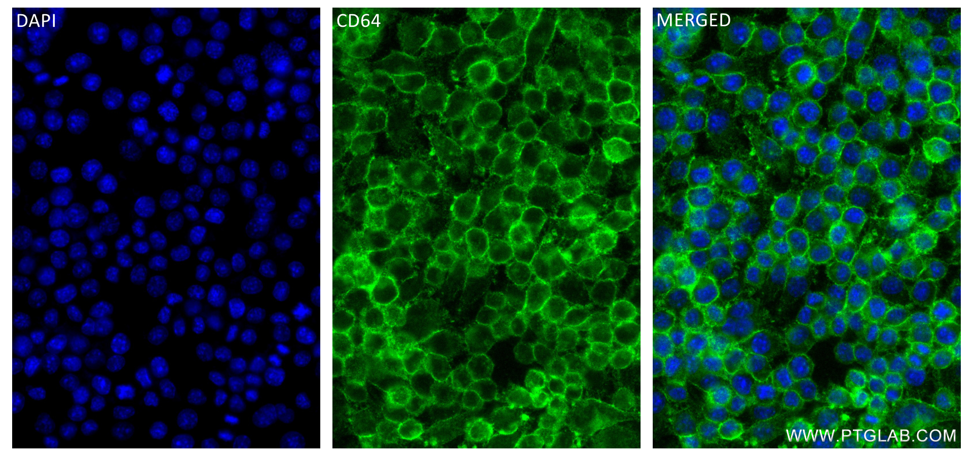 IF Staining of RAW 264.7 using 84518-2-RR
