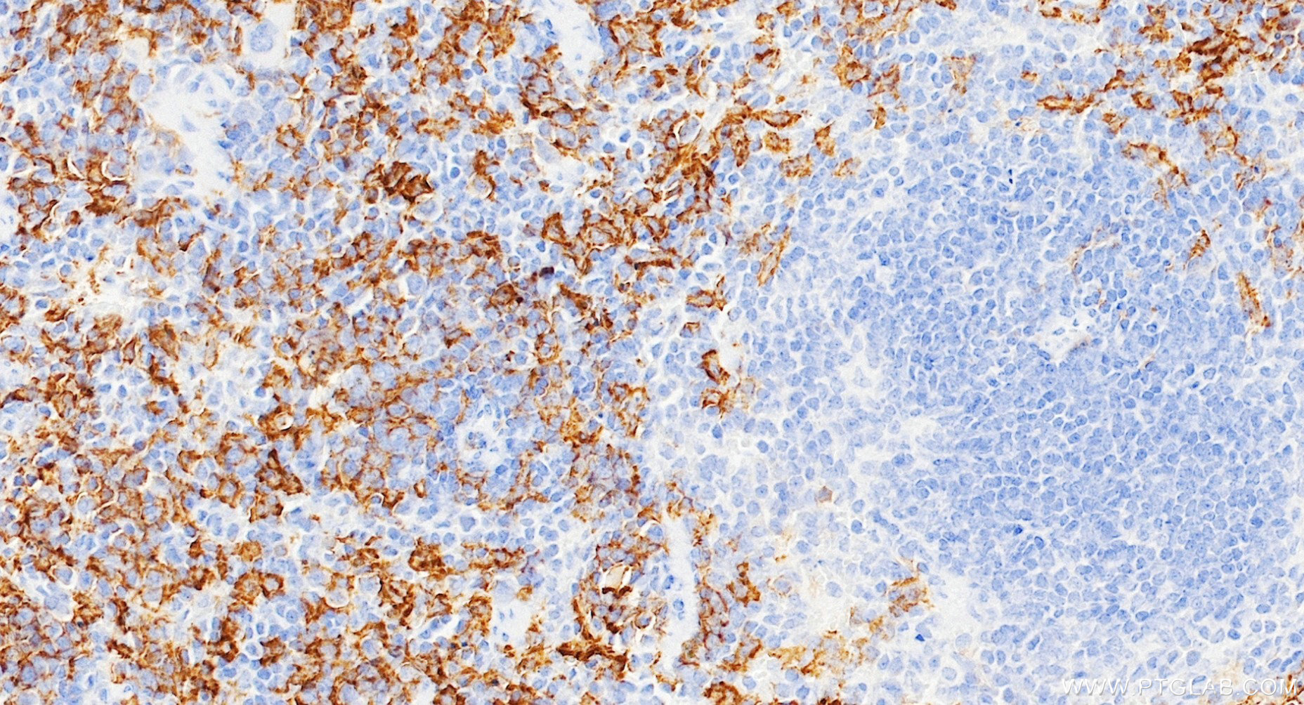 IHC staining of mouse spleen using 84518-2-RR IHC staining of mouse spleen using 84518-2-RR