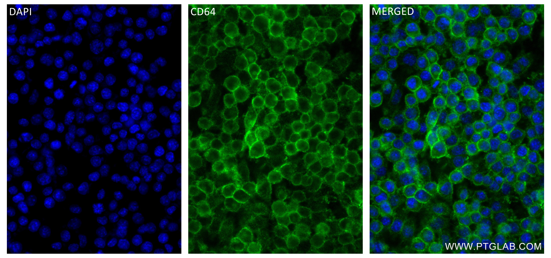 IF Staining of RAW 264.7 using 84518-3-RR