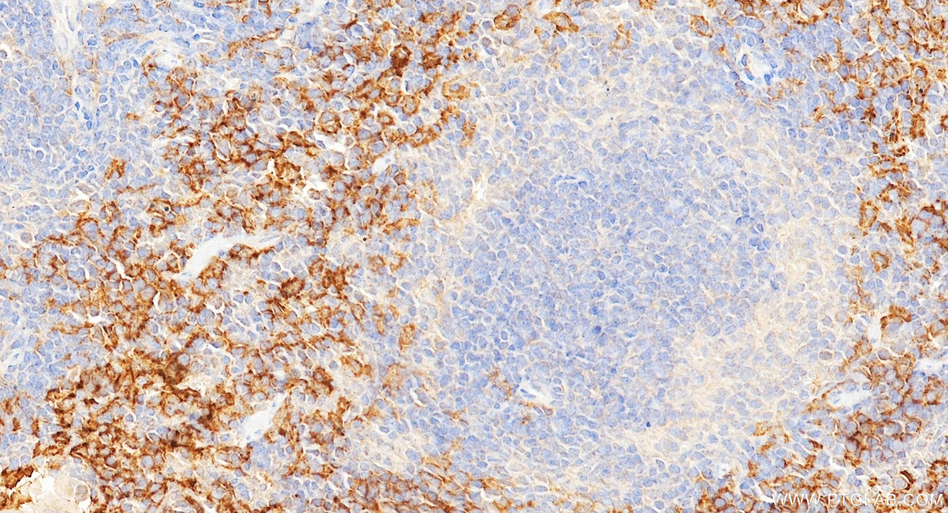 IHC staining of mouse spleen using 84518-3-RR