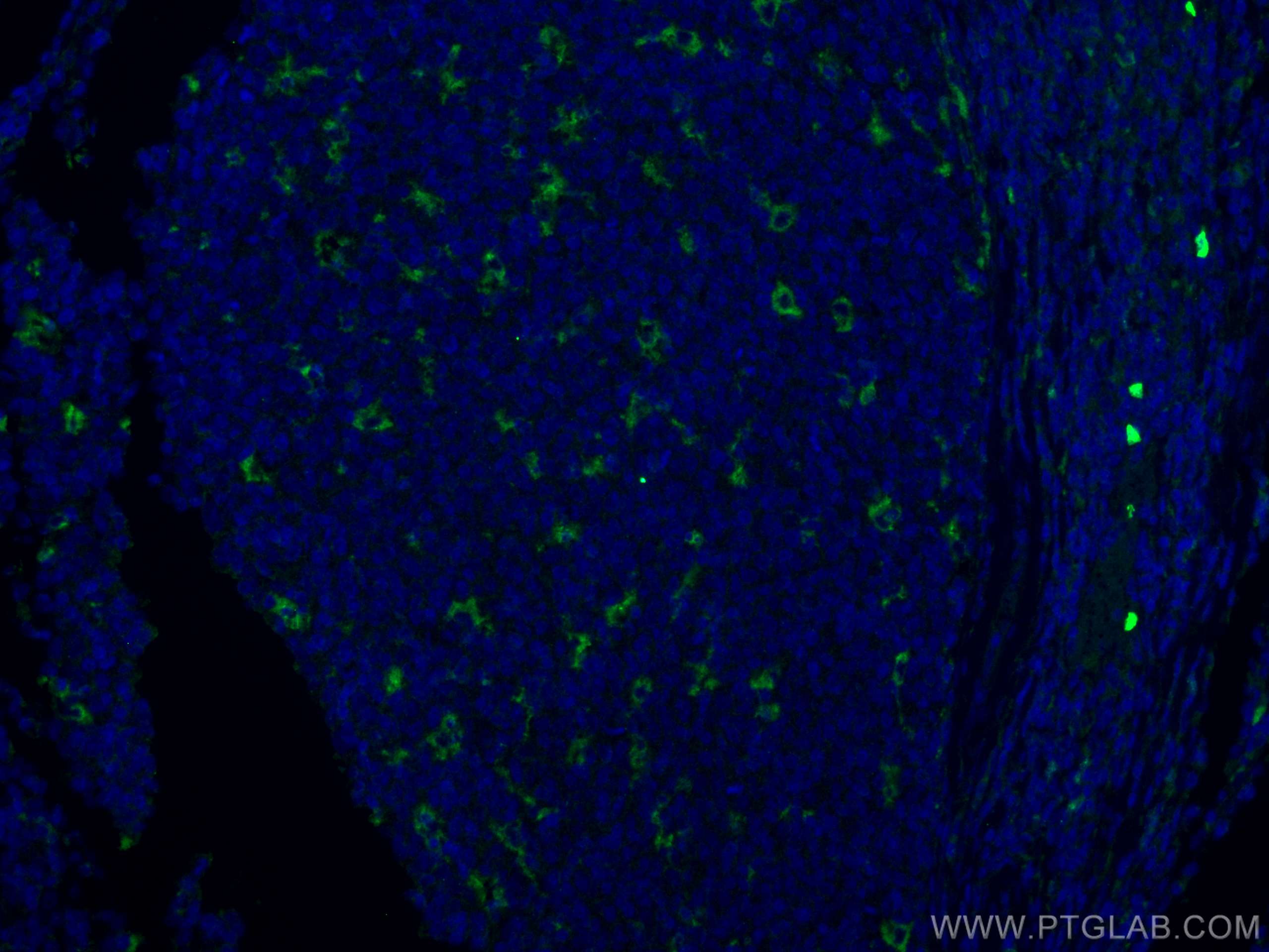 IF Staining of human tonsillitis using 25747-1-AP