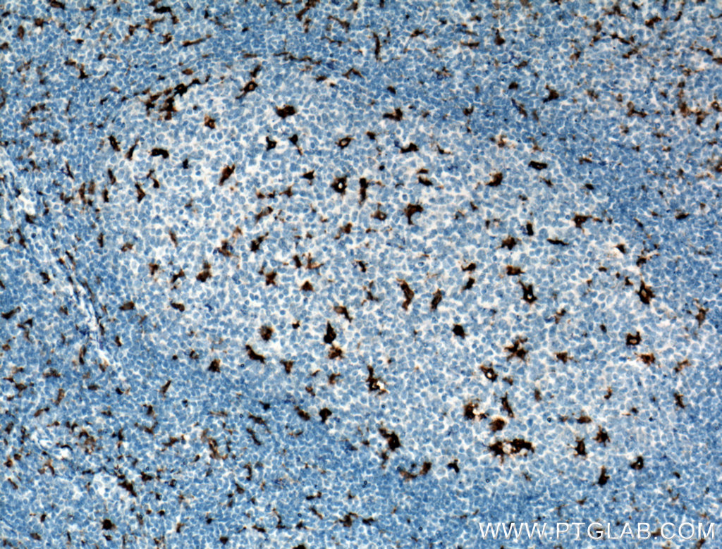 CD68 Monoclonal antibody