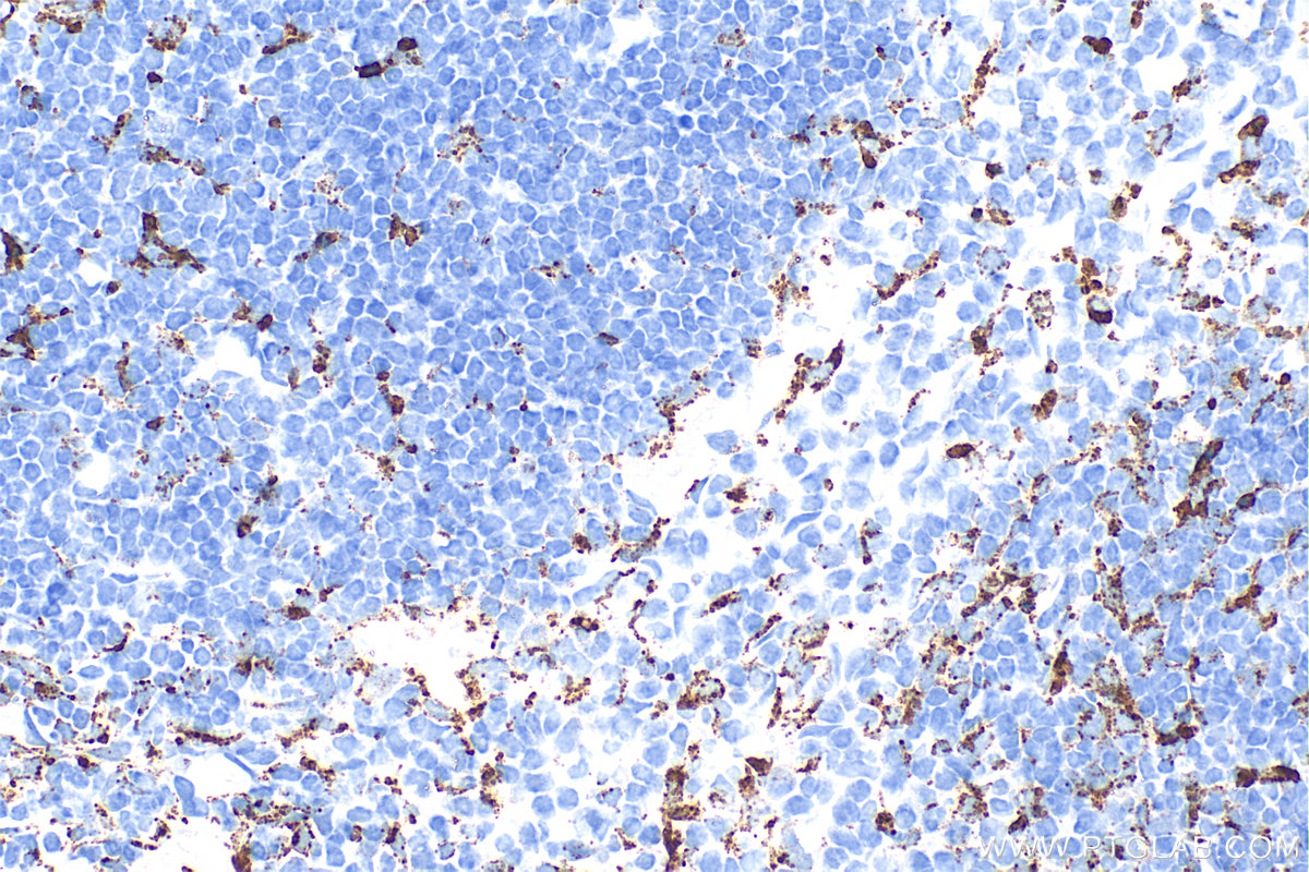 IHC staining of mouse spleen using 83014-5-RR