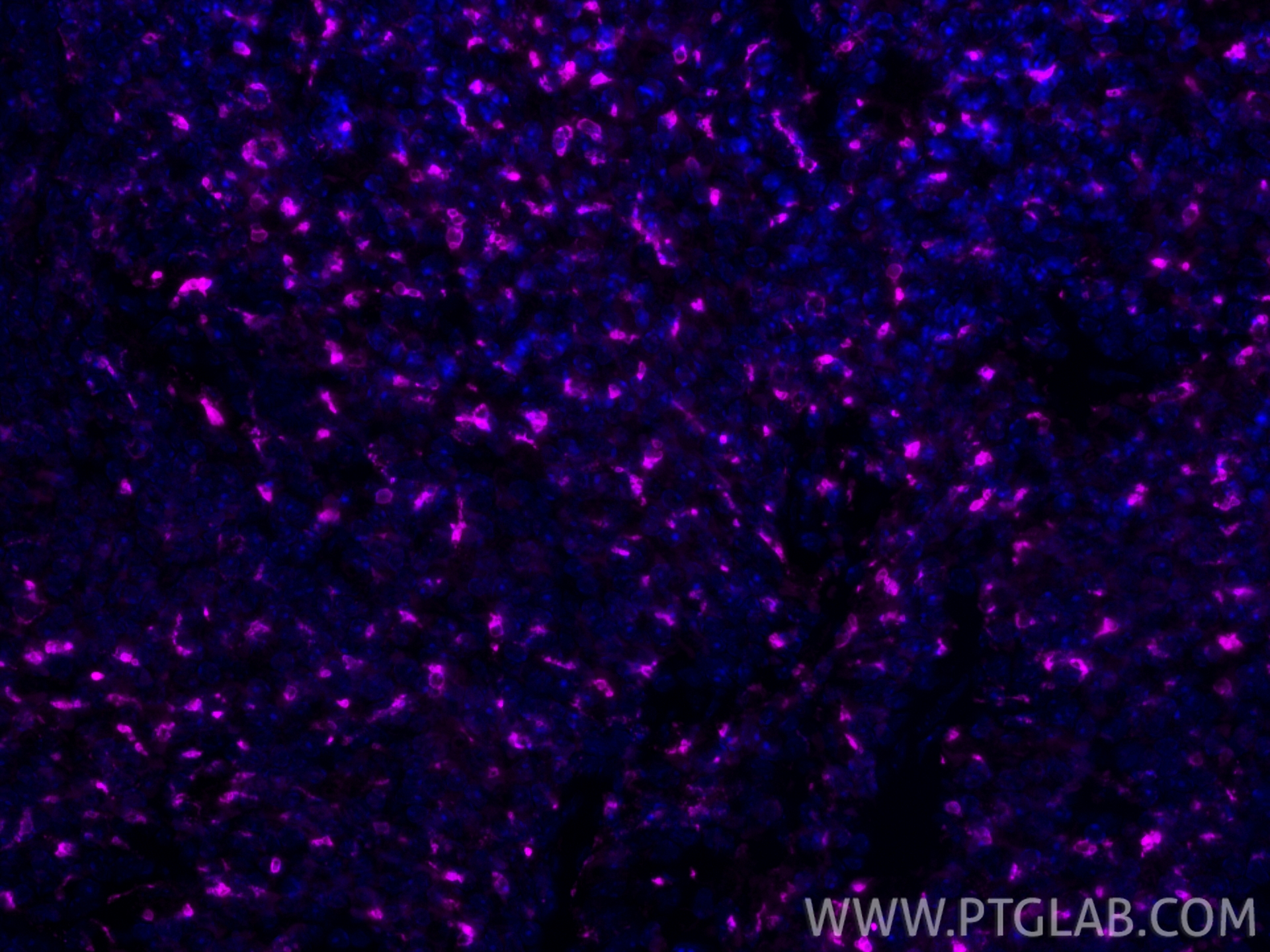 IF Staining of mouse spleen using APC-83014-5 IF Staining of mouse spleen using APC-83014-5