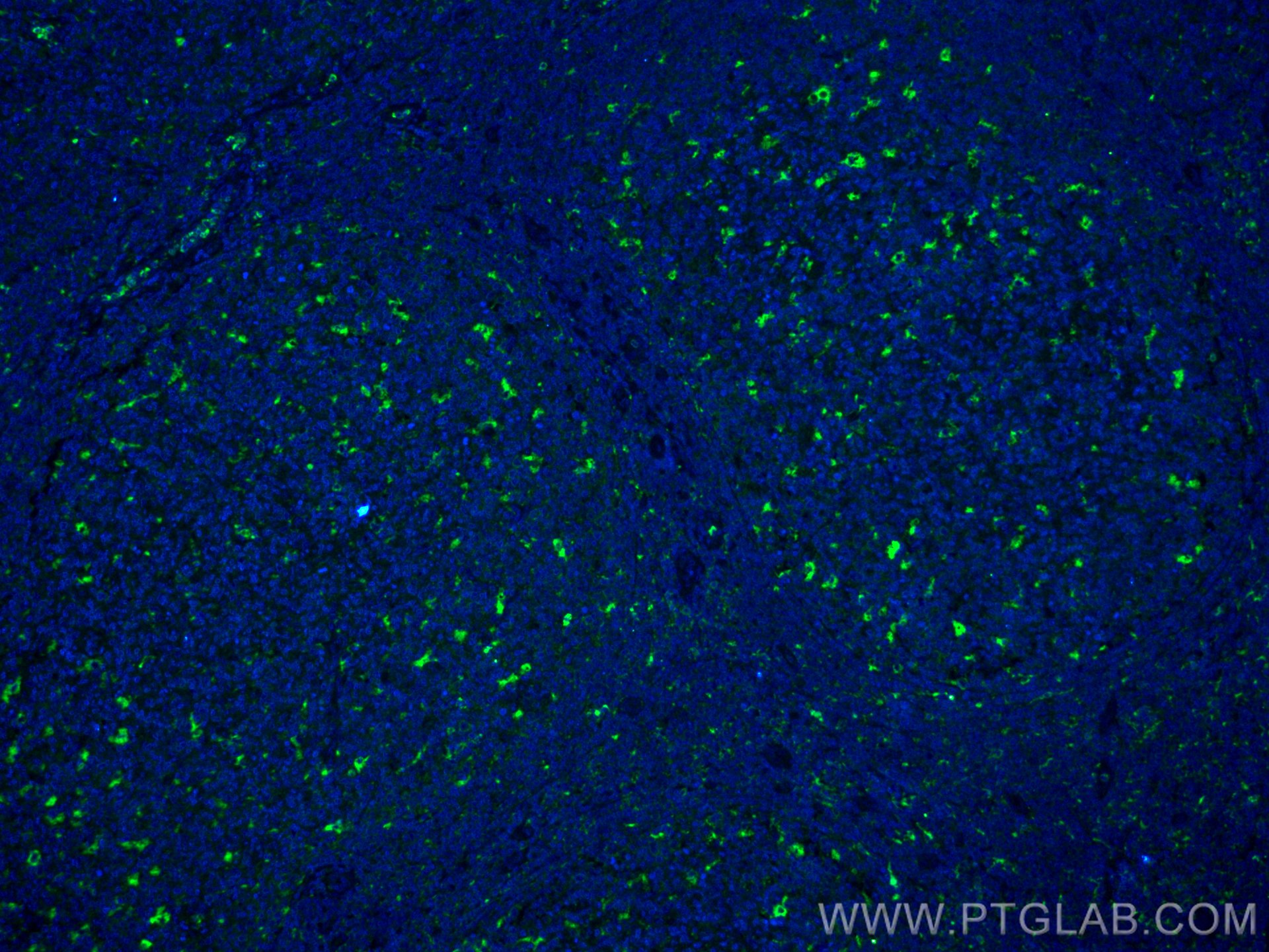IF Staining of human tonsillitis using CL488-25747